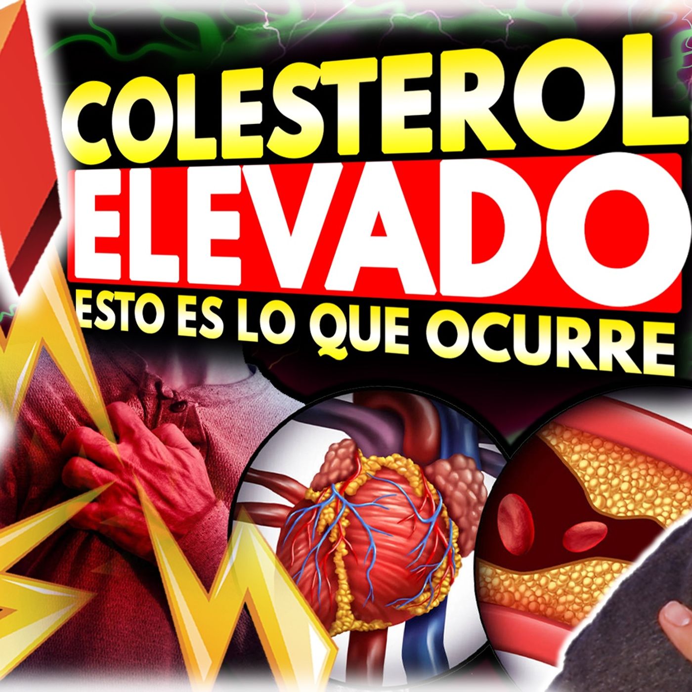 🔥⚠️Esto es lo que sucede en tu Organismo cuando tienes el COLESTEROL ALTO👨‍⚕️[¿Cuándo es PELIGROSO?] episode artwork