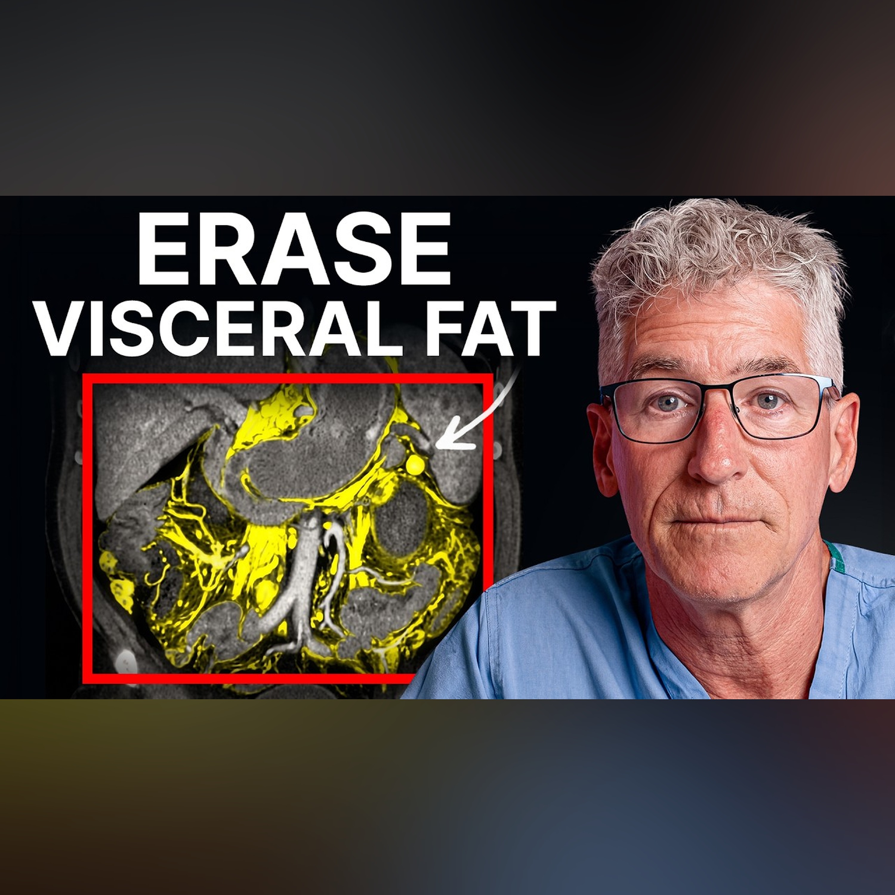 Visceral Fat Doctor: If I Wanted to Lose Visceral Fat FAST, I'd Do This episode artwork