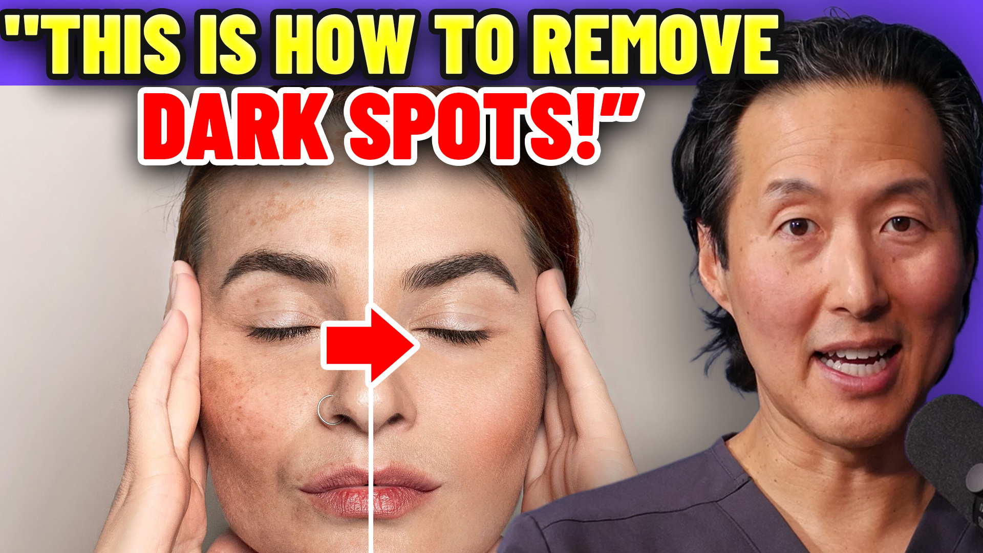 Why Your Dark Spots Won't Go Away (And How to Finally Fix Them) episode artwork
