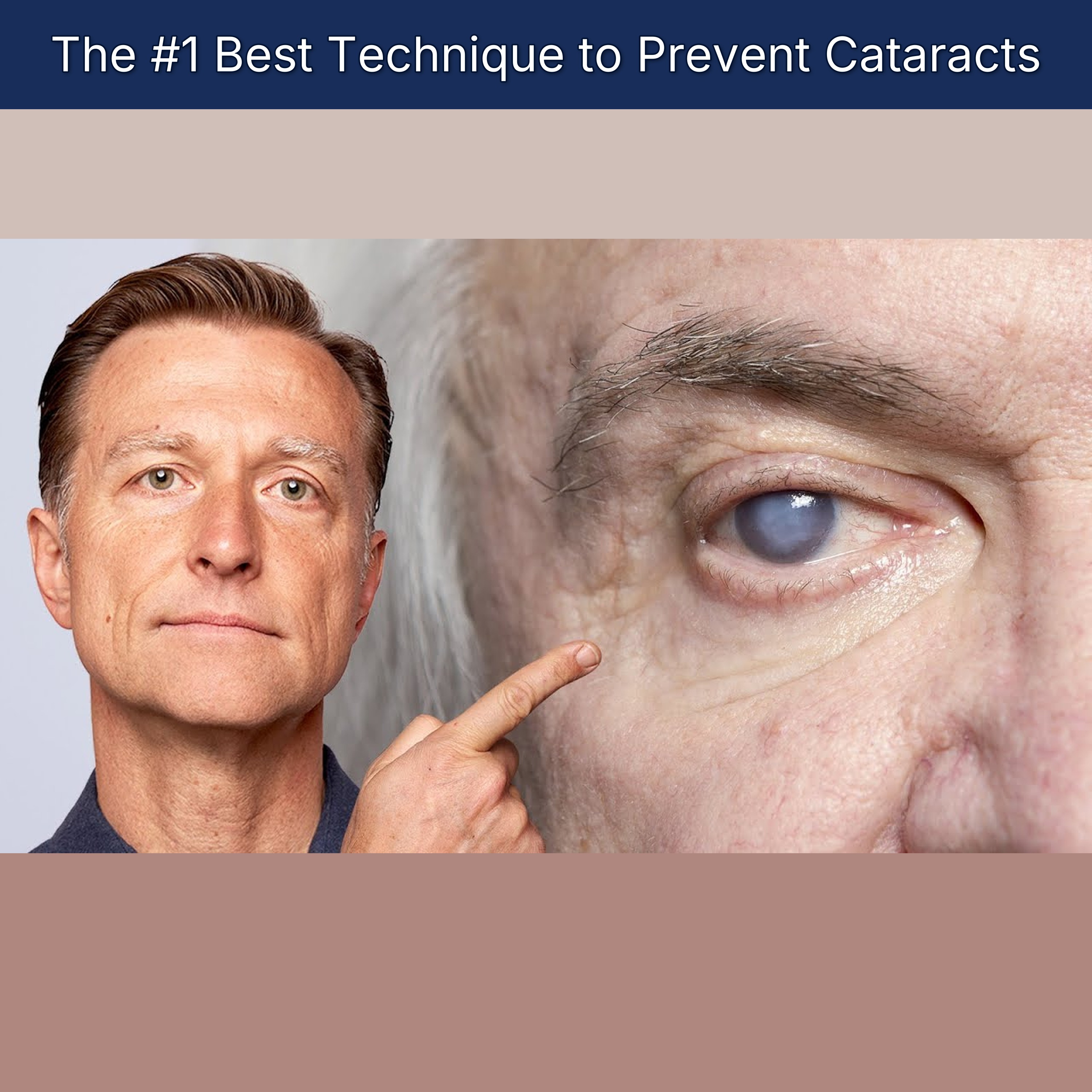 The #1 Best Technique to Prevent Cataracts