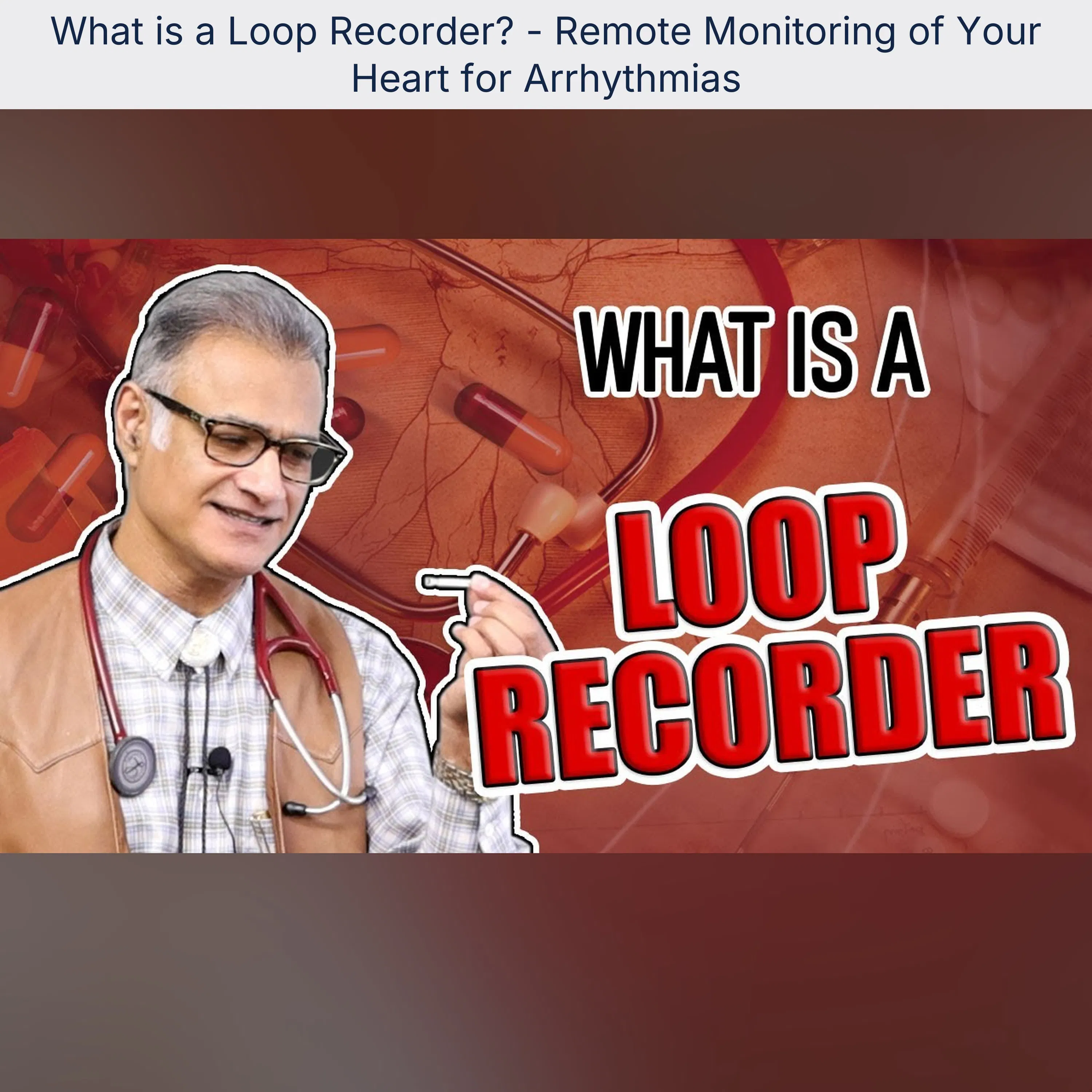 What is a Loop Recorder? - Remote Monitoring of Your Heart for Arrhythmias