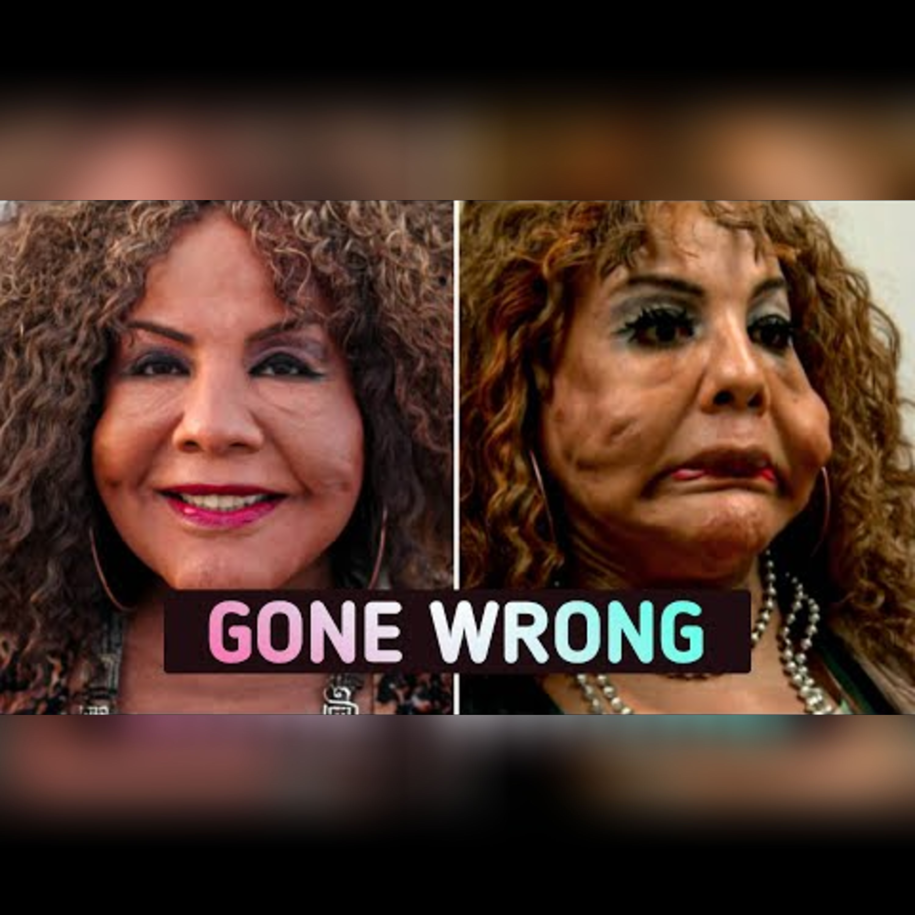 The Dangers of Illegal Plastic Surgeries episode artwork