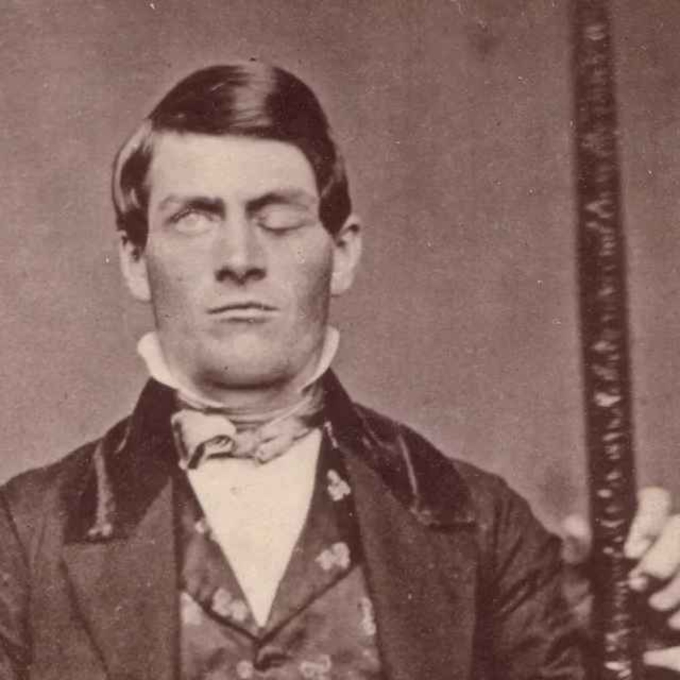 The Man With The Hole In His Head