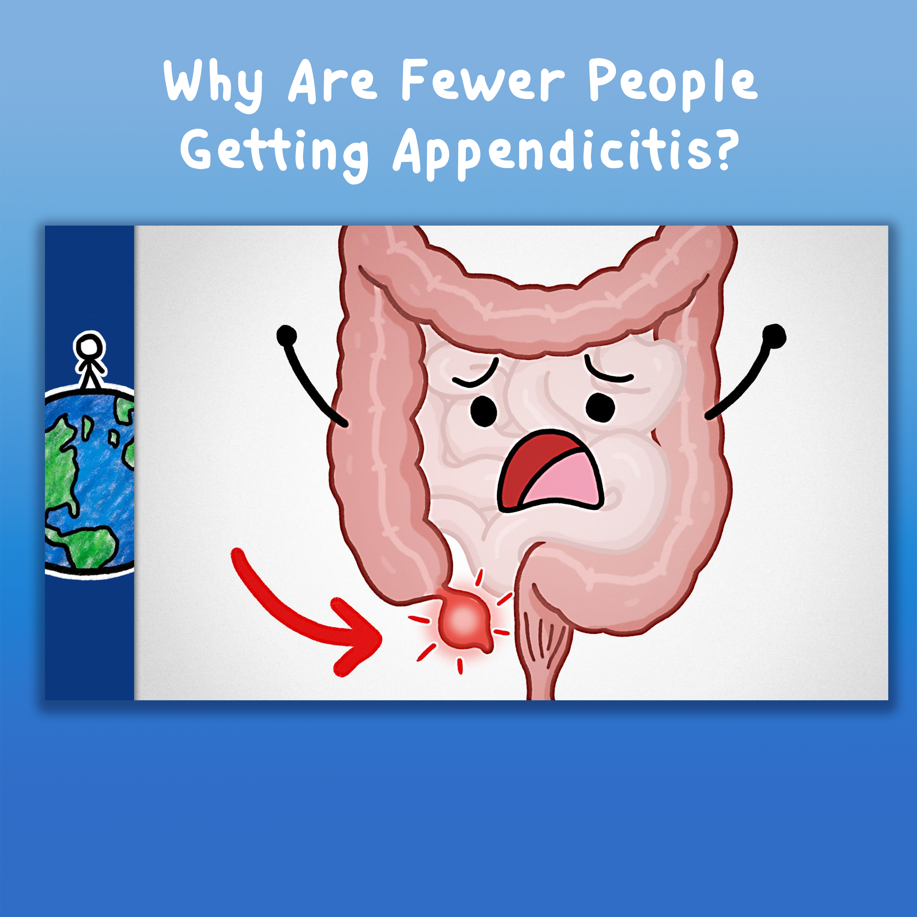 Why Are Fewer People Getting Appendicitis?