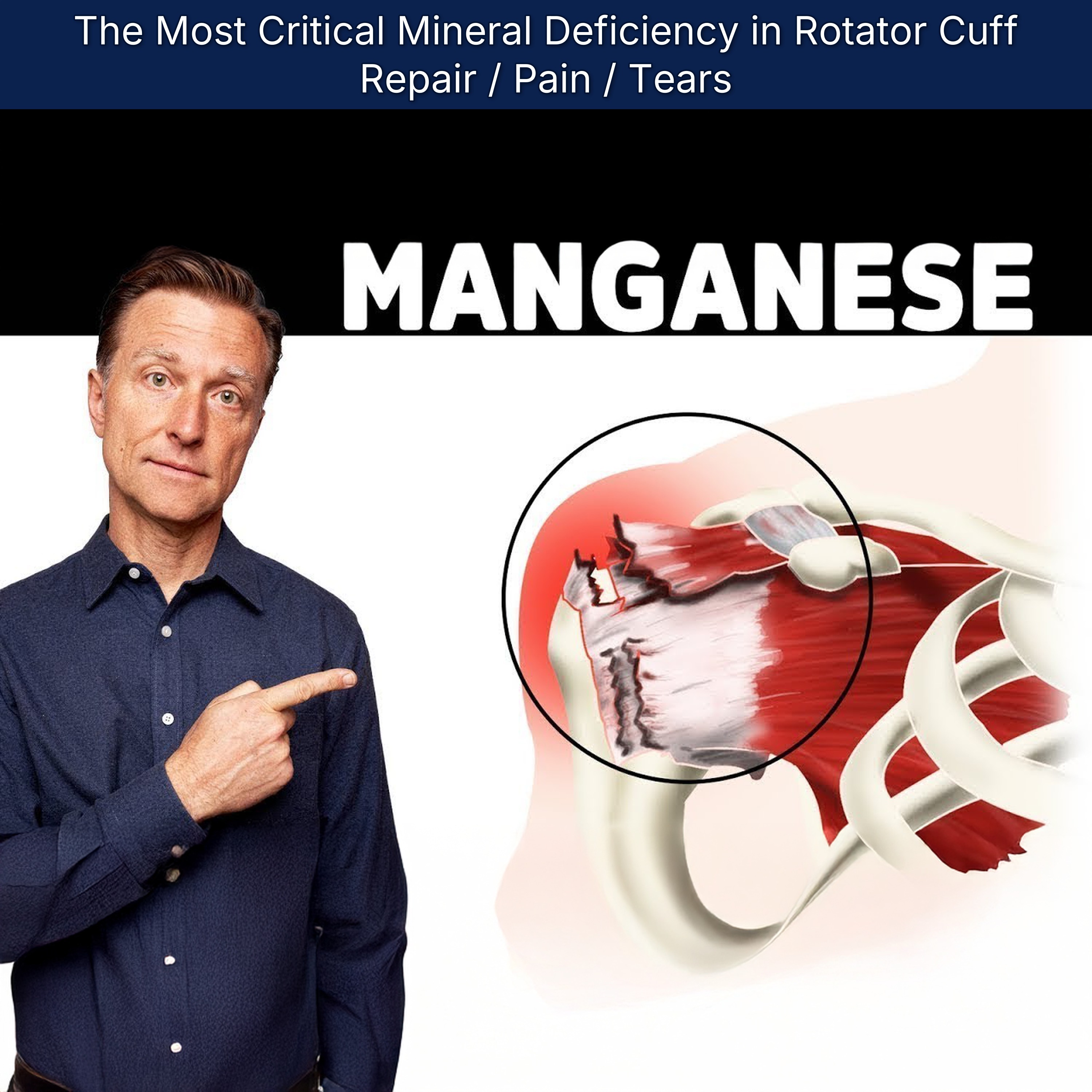 The Most Critical Mineral Deficiency in Rotator Cuff Repair / Pain / Tears