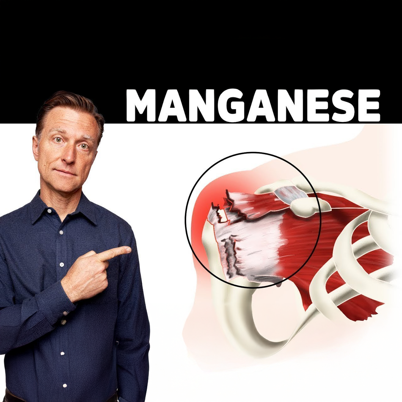 The Top Mineral Deficiency in Rotator Cuff Repair / Pain / Tears