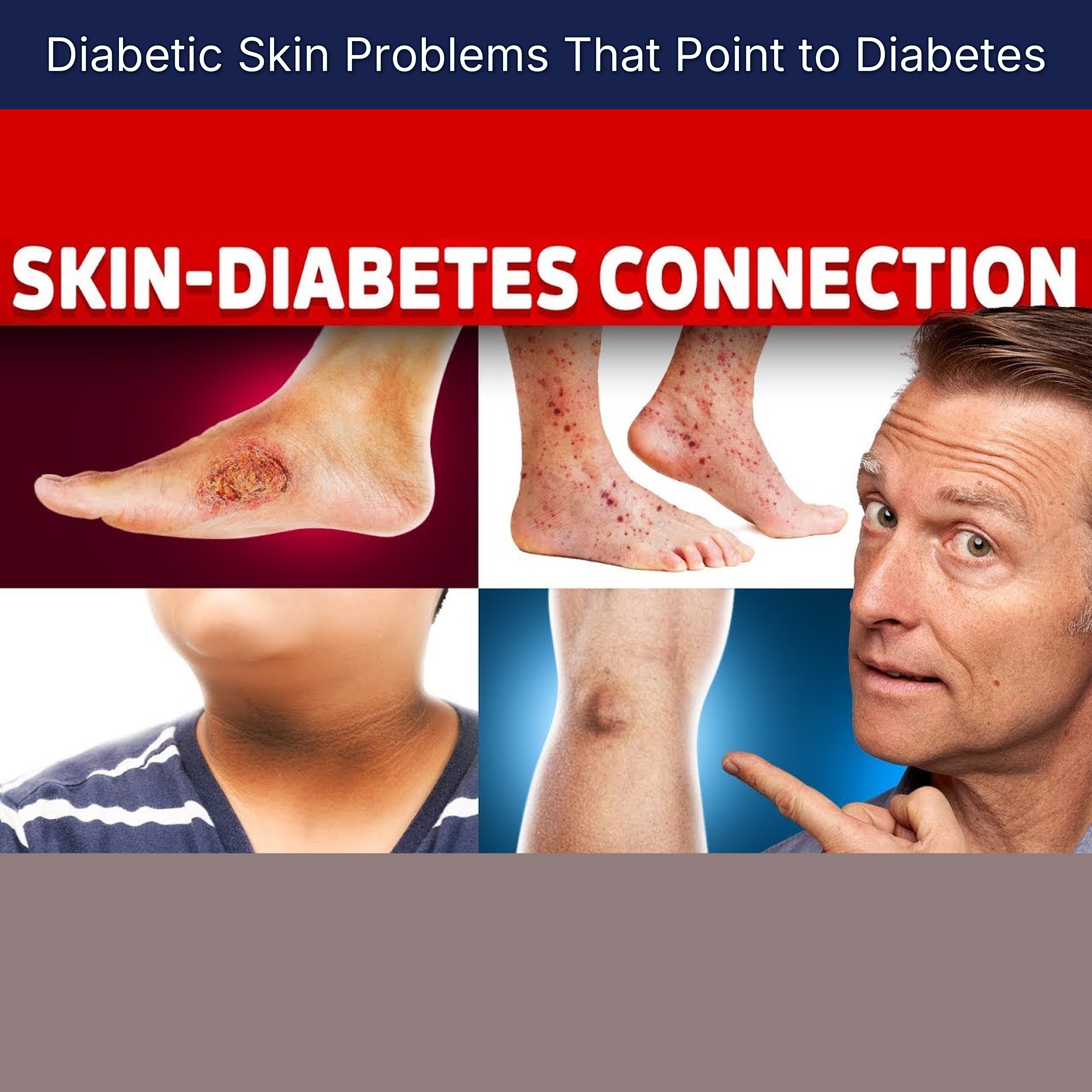 Diabetic Skin Problems That Point to Diabetes