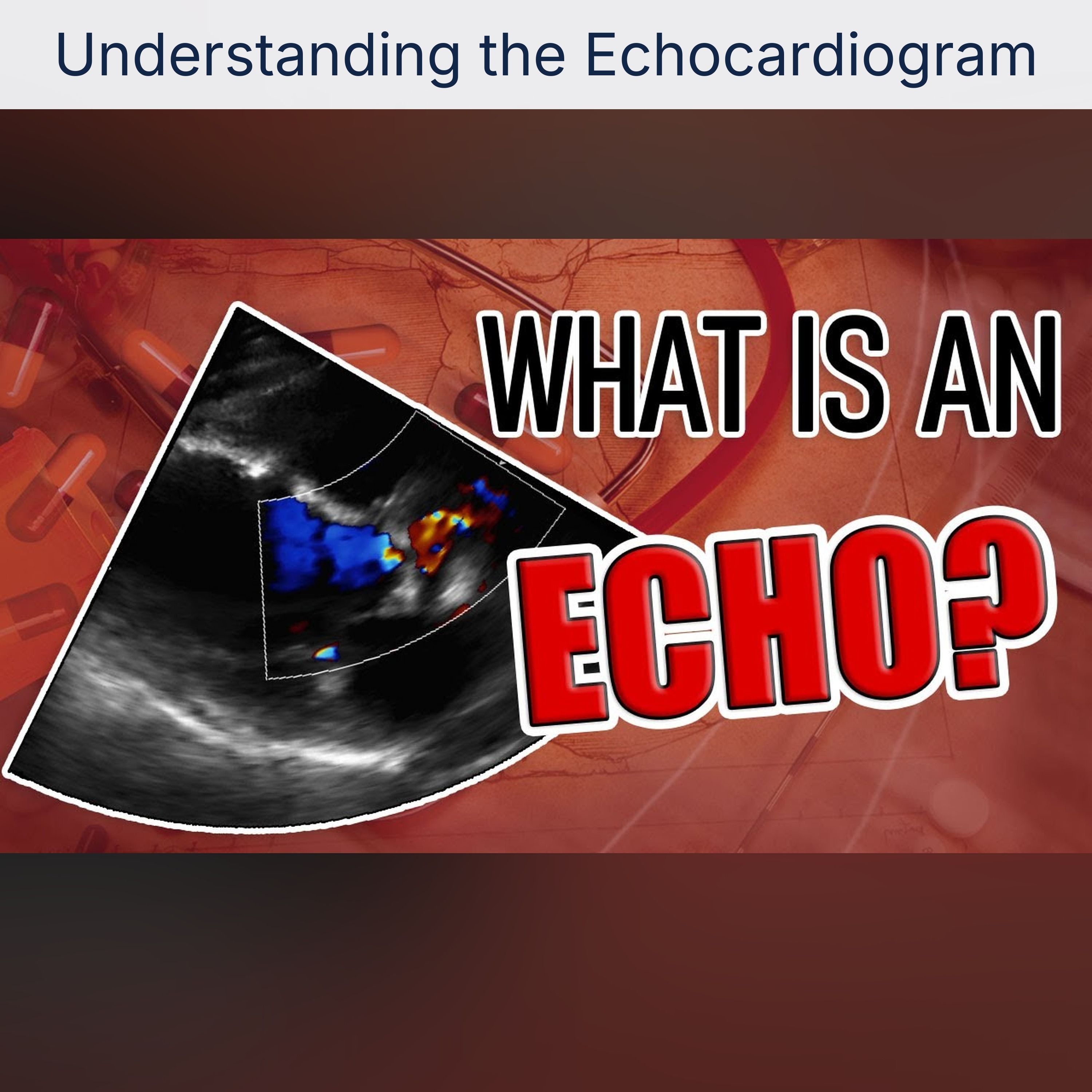 Understanding the Echocardiogram