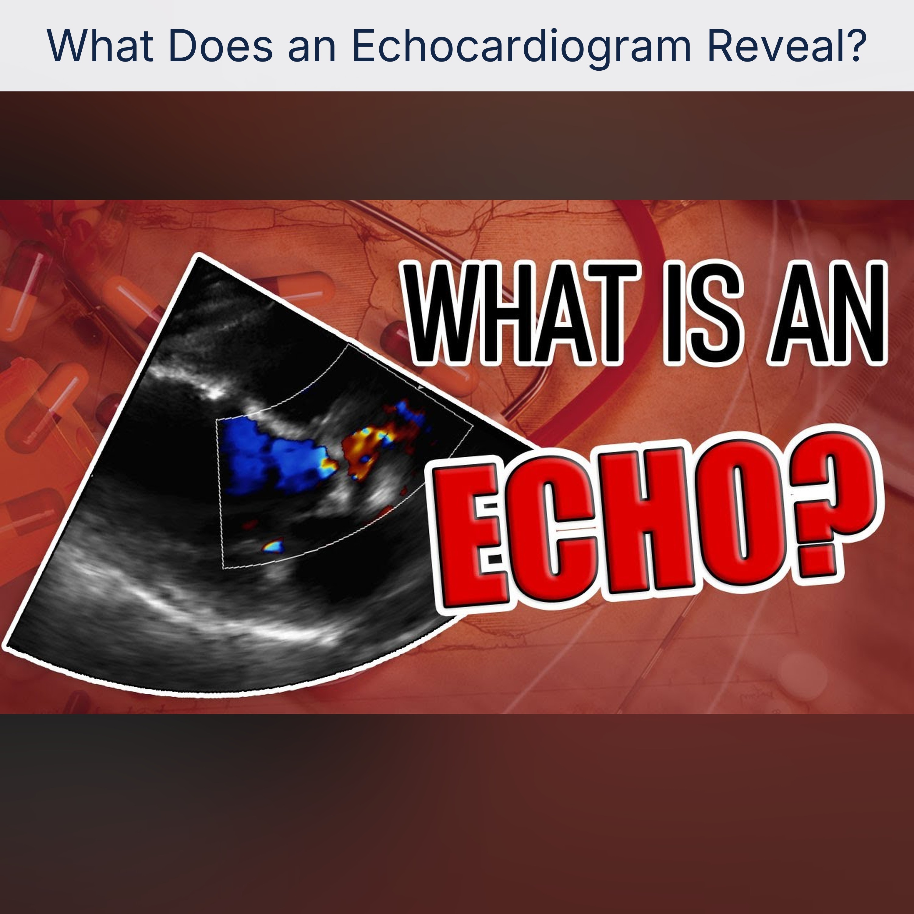 What Does an Echocardiogram Reveal? episode artwork