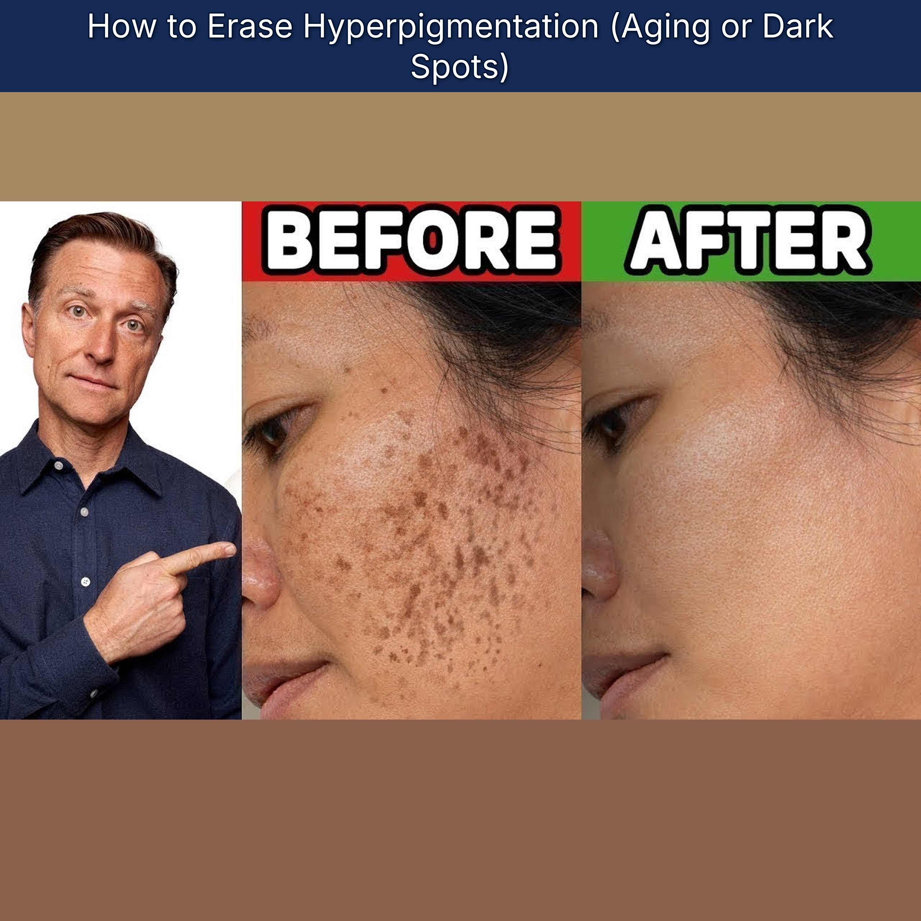 How to Erase Hyperpigmentation (Aging or Dark Spots) episode artwork