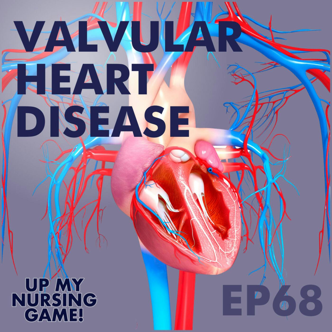 Valvular Heart Disease with Tim Madeira, DNP Valvular Heart Disease with Tim Madeira, DNP