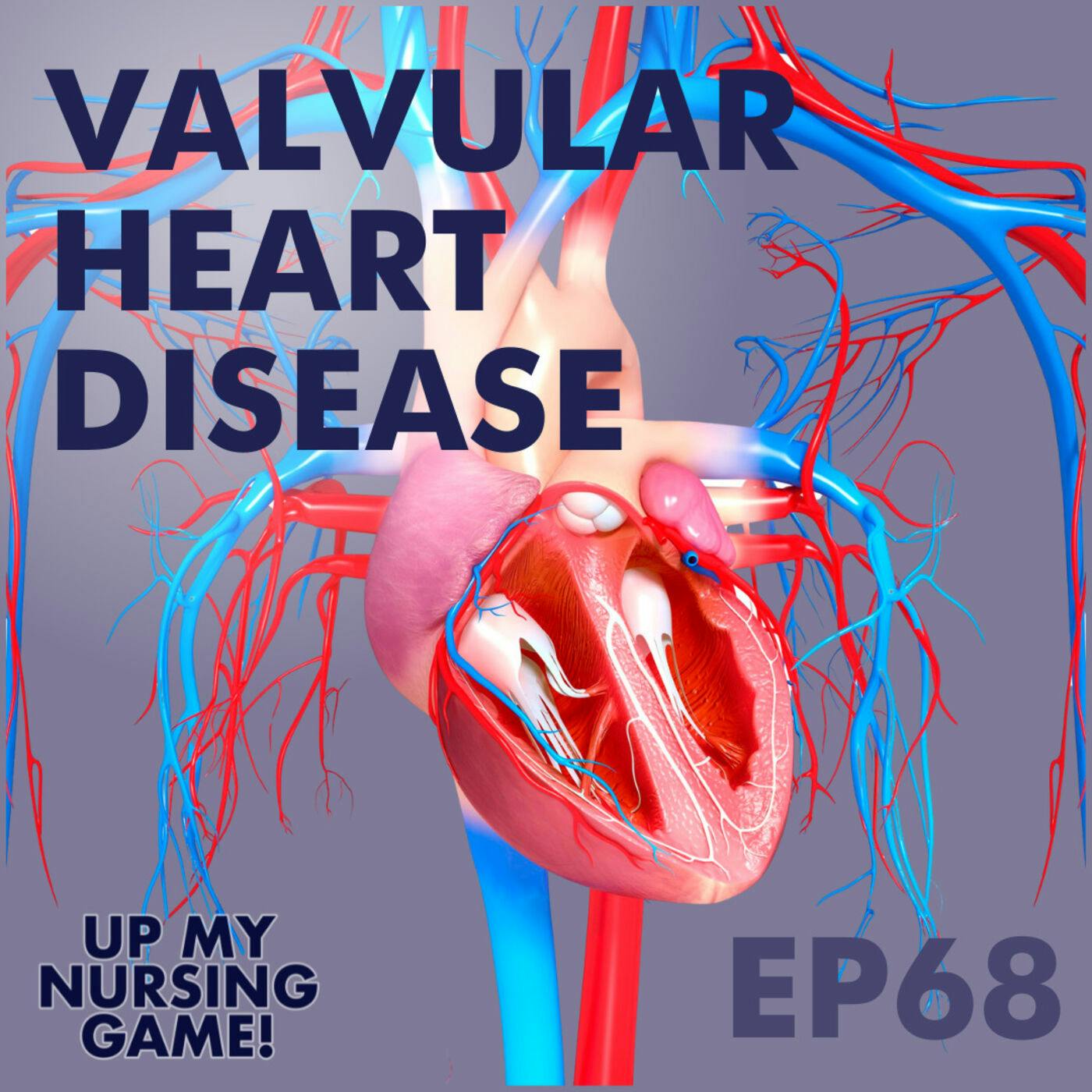 Valvular Heart Disease with Tim Madeira, DNP