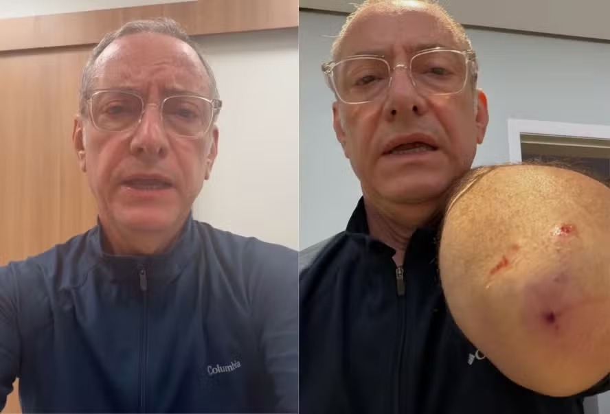 José Roberto Burnier, apresentador do 'SP2' é atacado por pitbull sem guia: 'Está tudo bem agora' episode artwork