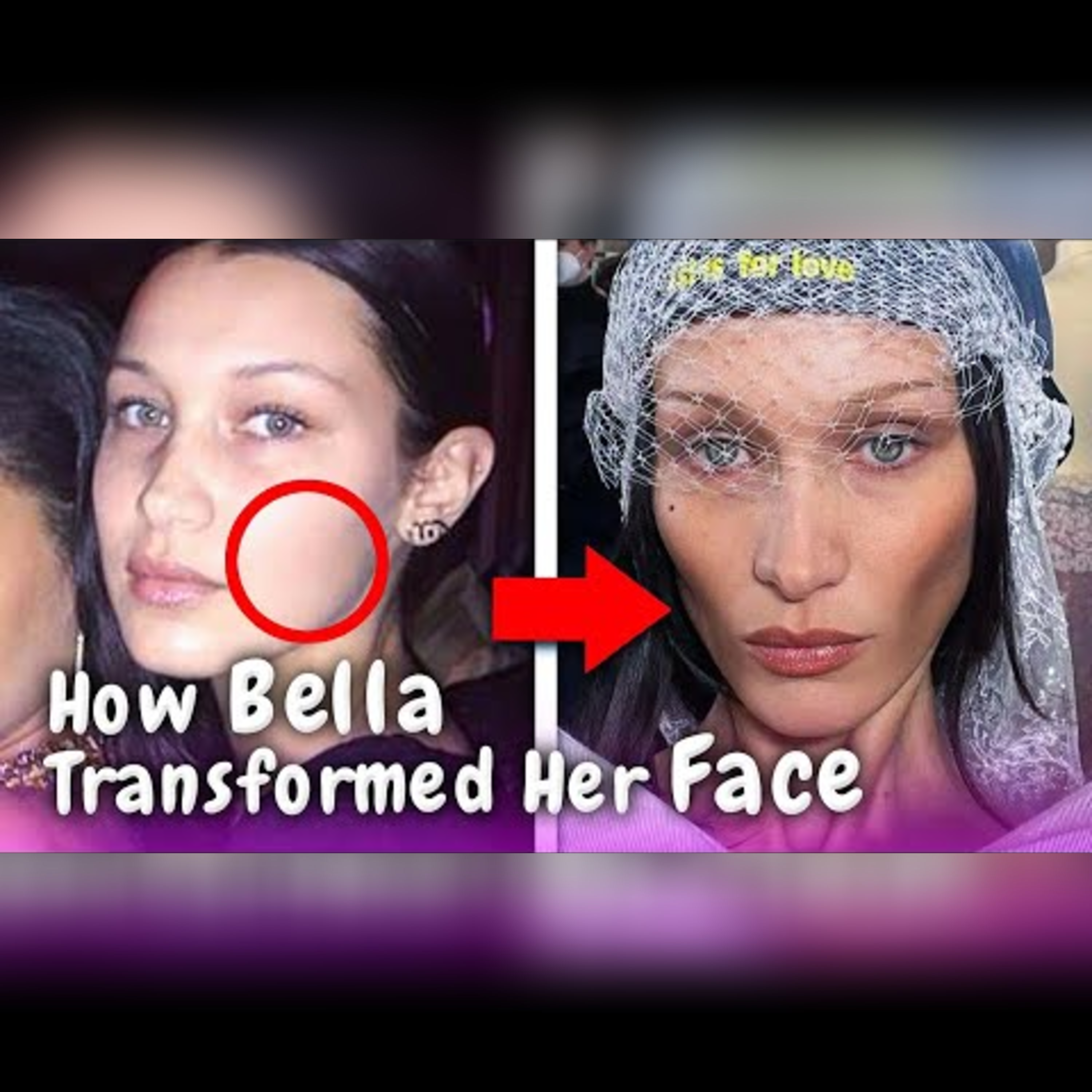 Is Buccal Fat Removal the Latest Beauty Craze? episode artwork