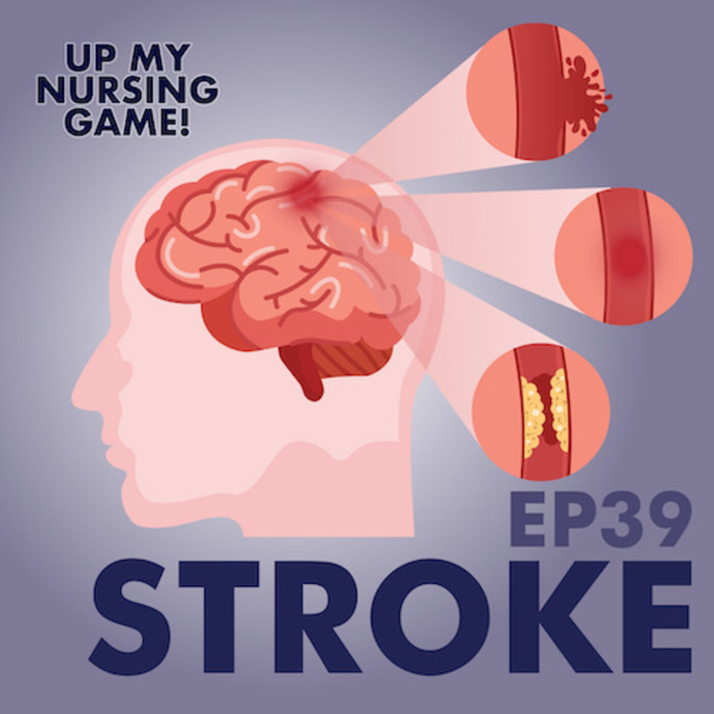 Stroke Diagnostics, Intervention and Complications with Sarah Lorenzini, RN, MSN episode artwork