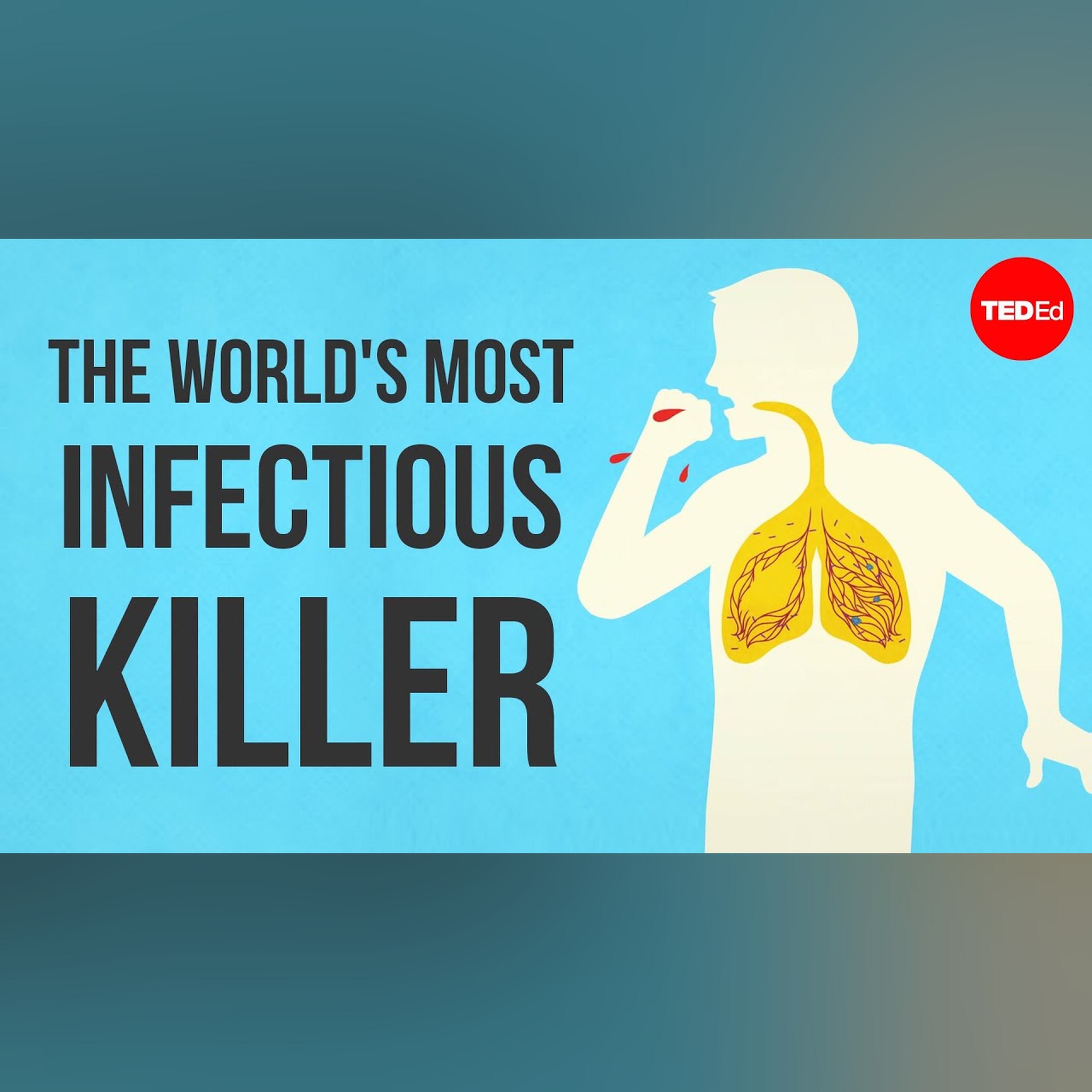 What makes tuberculosis (TB) the world's most infectious killer? - Melvin Sanicas episode artwork