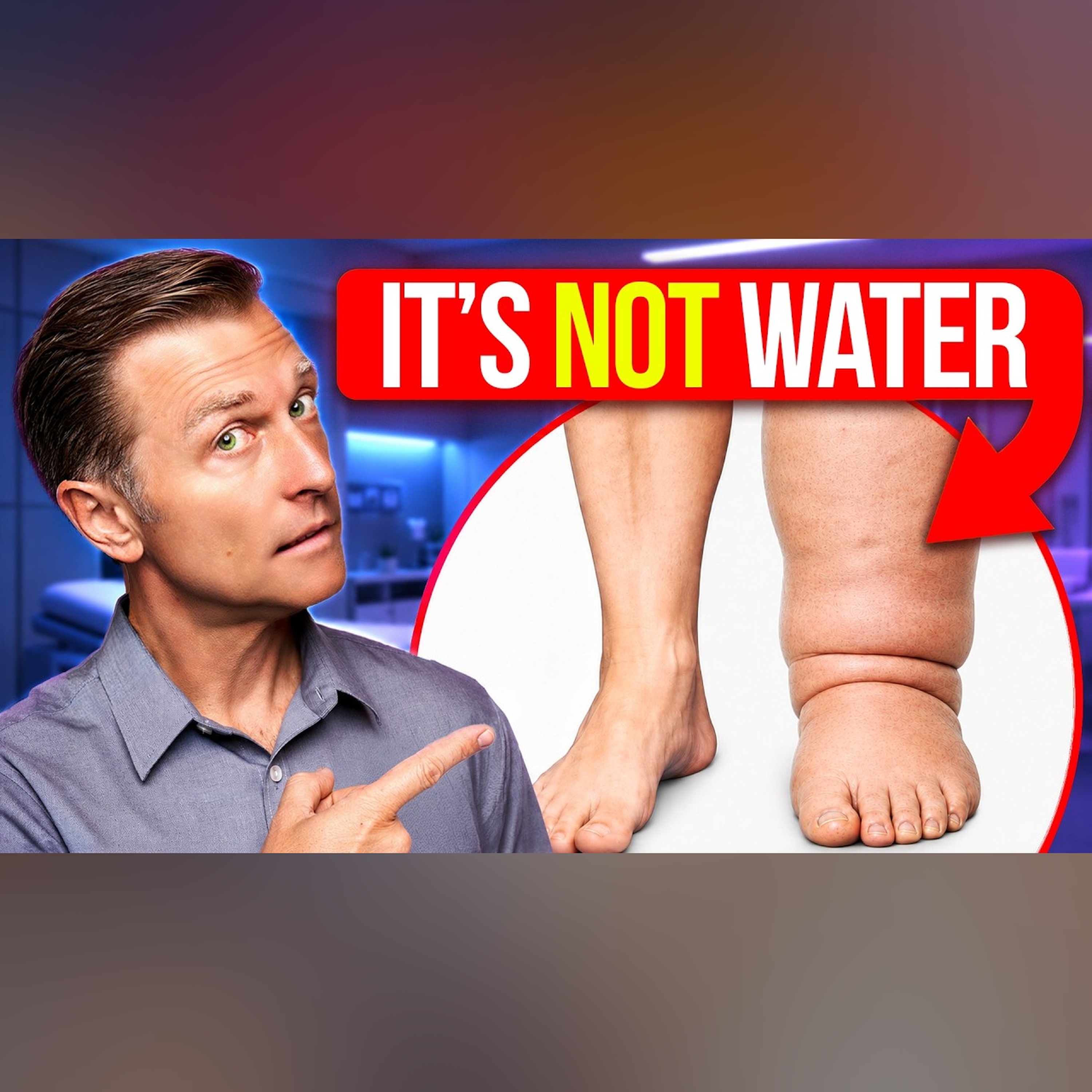 Lymphedema: What Doctors Don't Tell You (Diet Connection) episode artwork