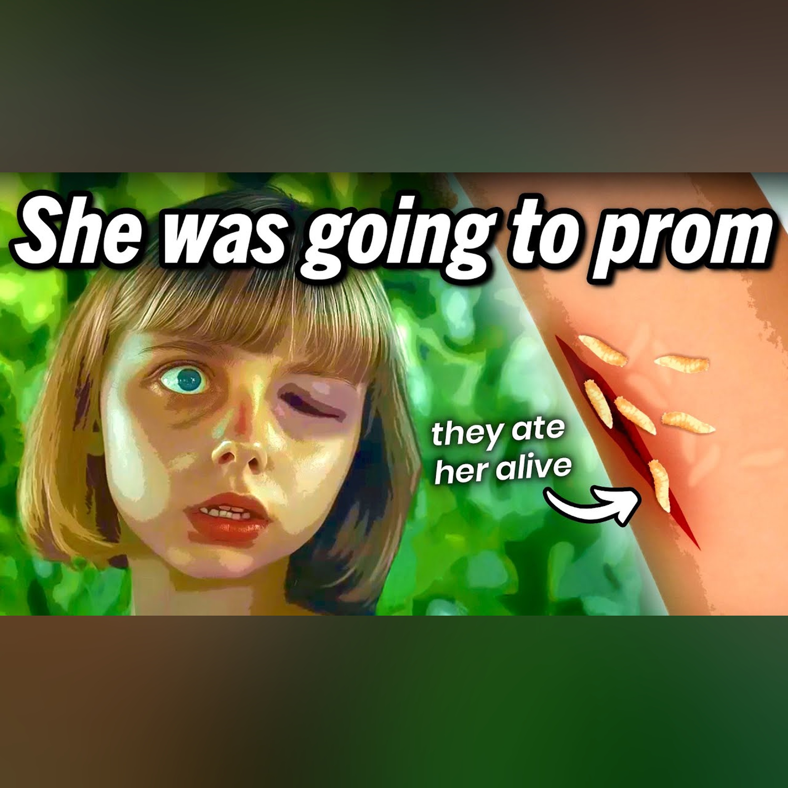 Girl Goes to Prom, Wakes Up Strapped to a Chair in the Amazon Rainforest episode artwork