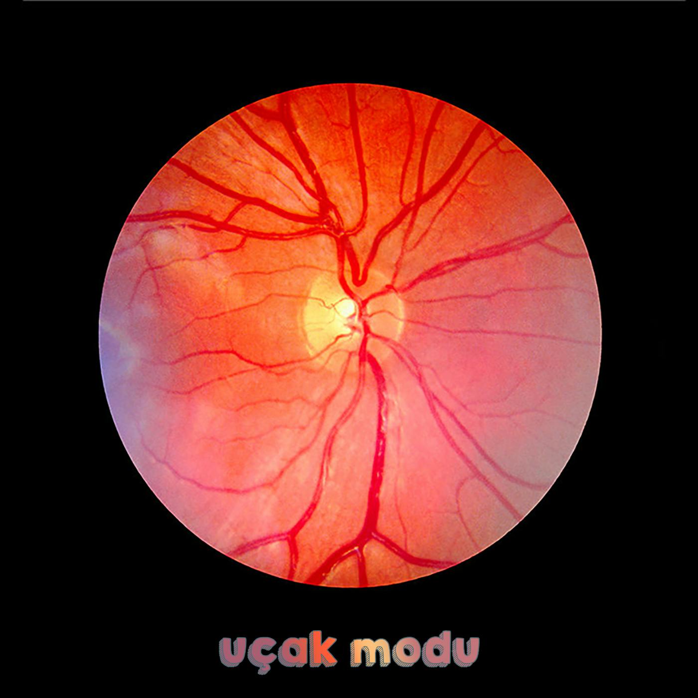 Yapay Zeka, Retina Hastalıklarında Nasıl Kullanılıyor? #11