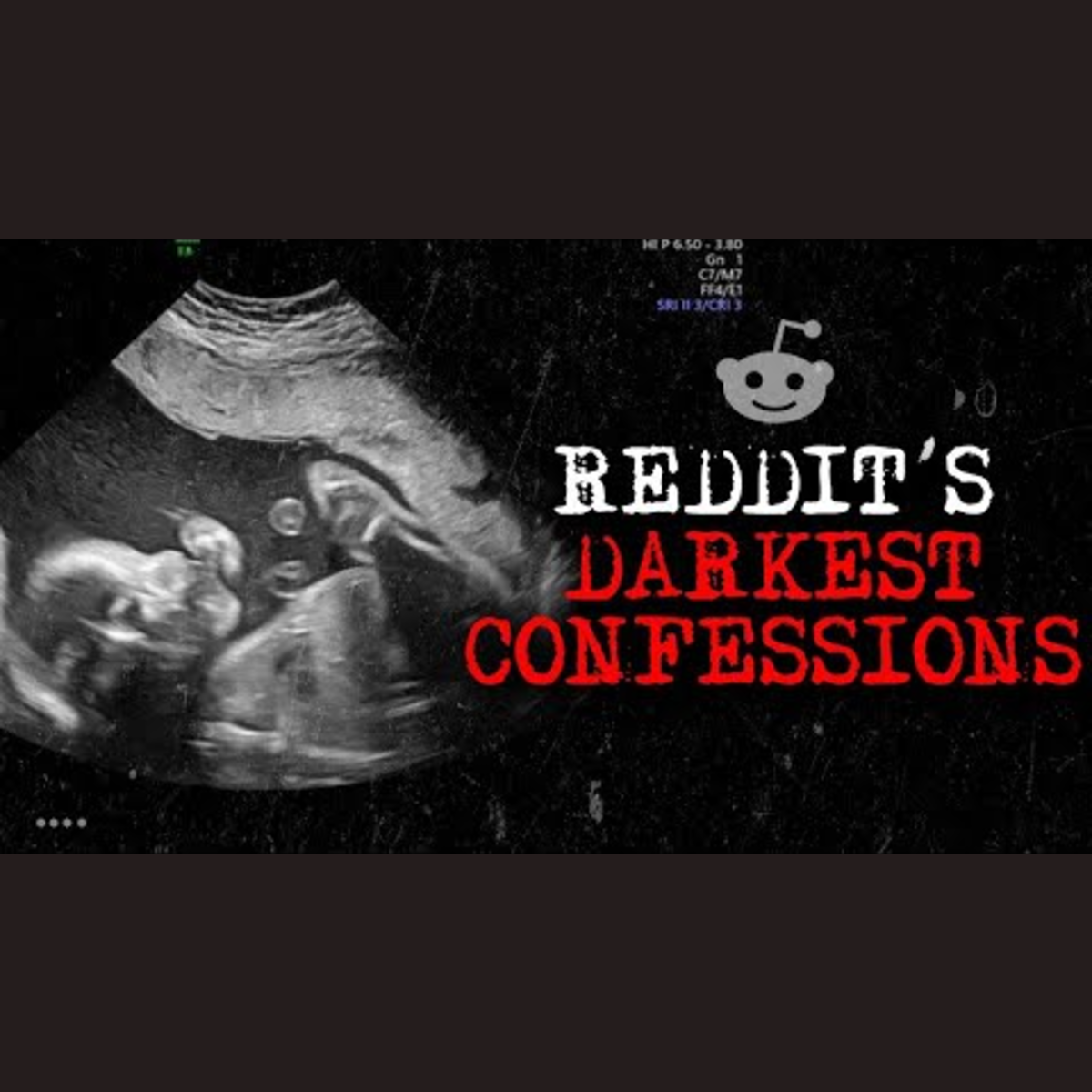 Episode 3: The Darkest Confessions of Reddit episode artwork