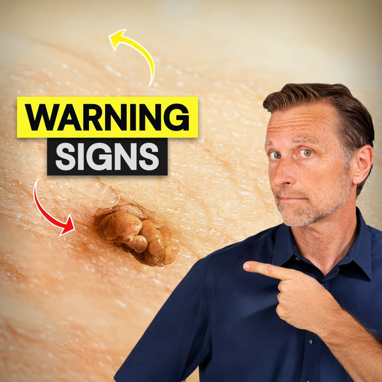 How to Remove Skin Tags and Warts Overnight