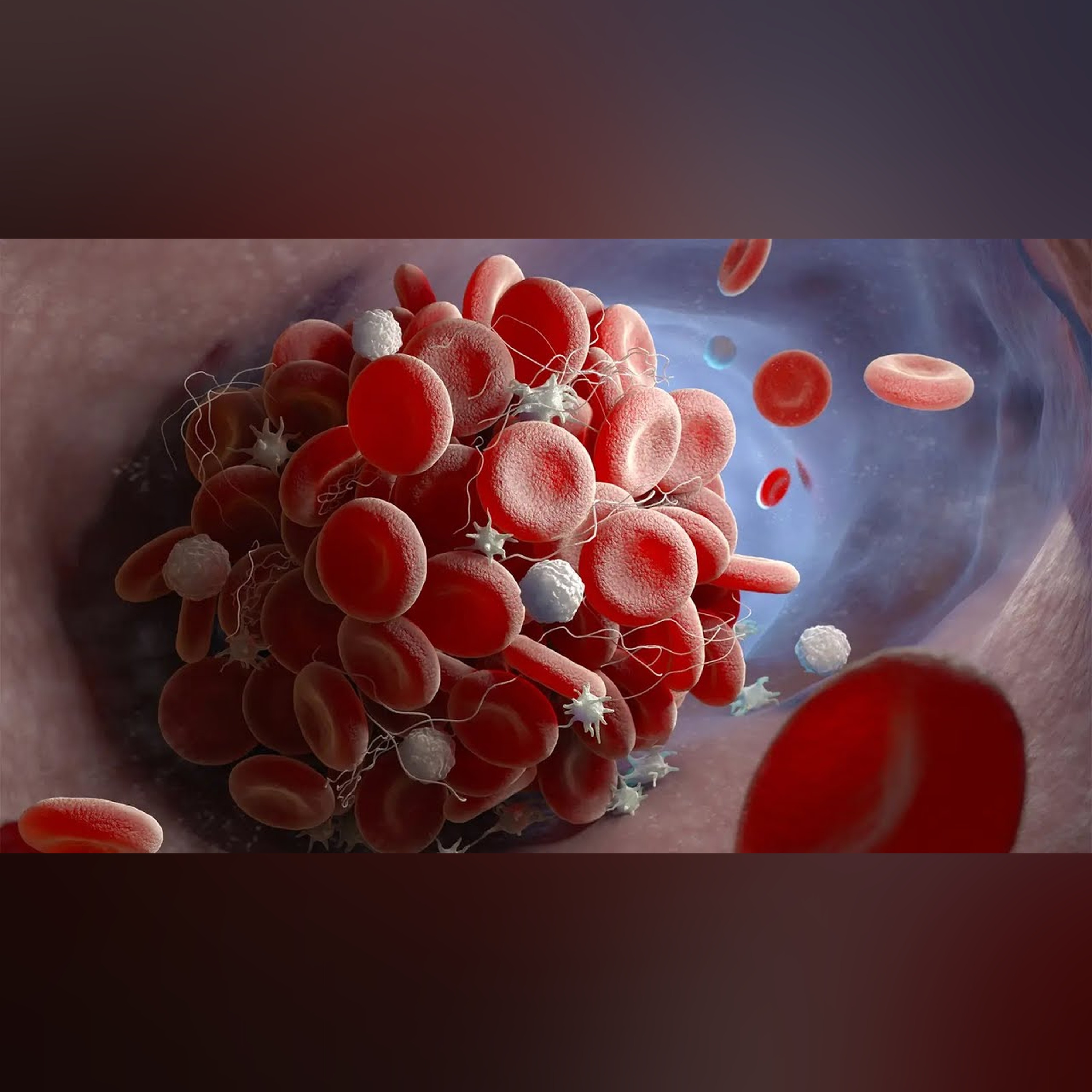 Thromboembolic Drugs Part 1: Principles of Platelet Activation