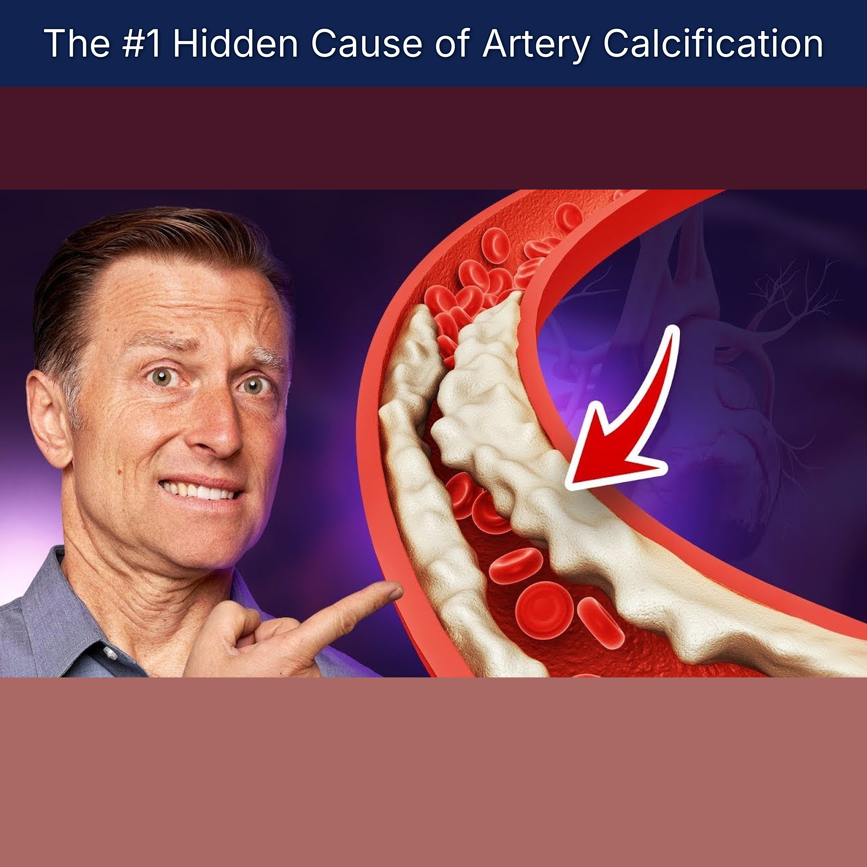 The #1 Hidden Cause of Artery Calcification