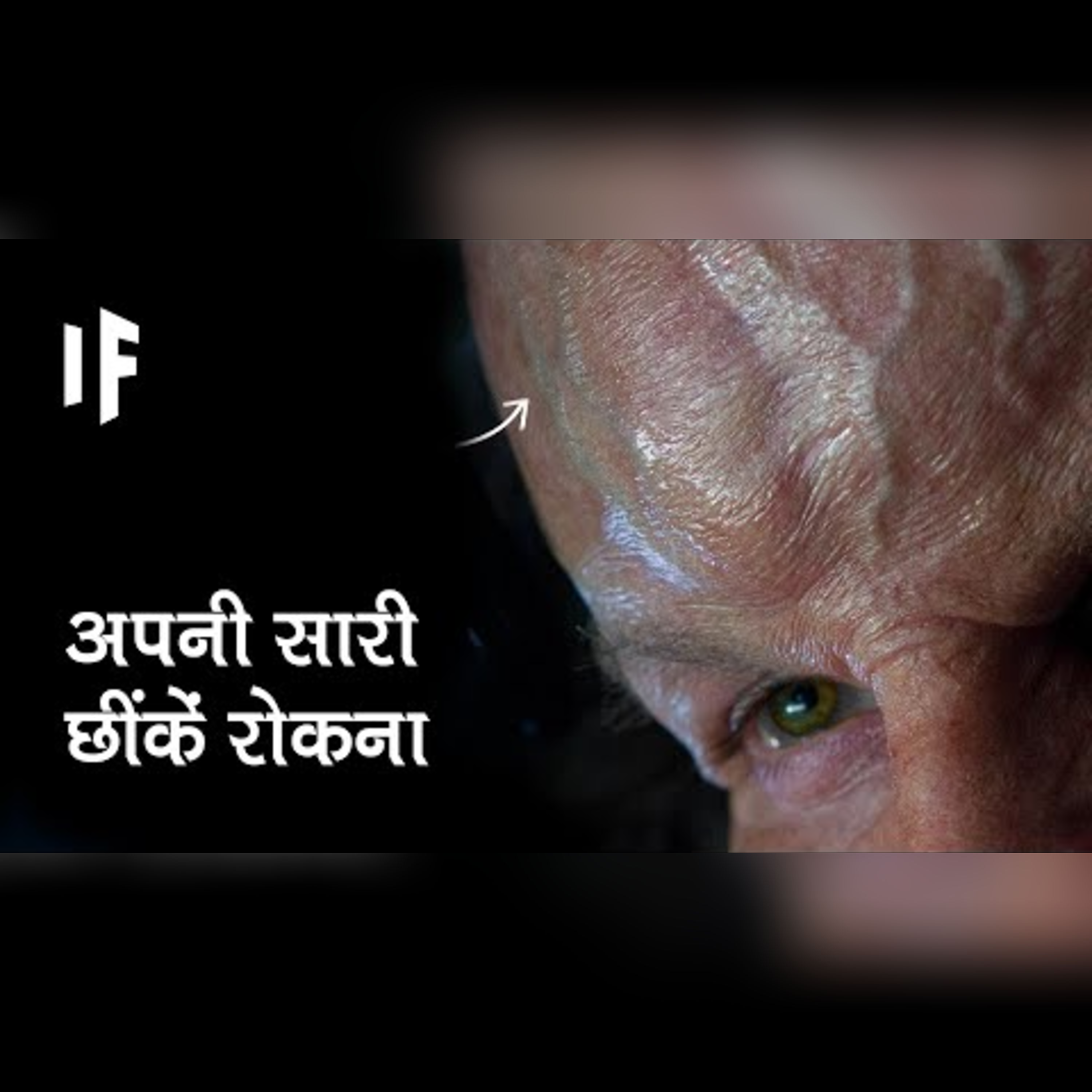 क्या हो अगर आप अपनी सारी छींकें रोक लें | What If We Held In All Our Sneezes? episode artwork