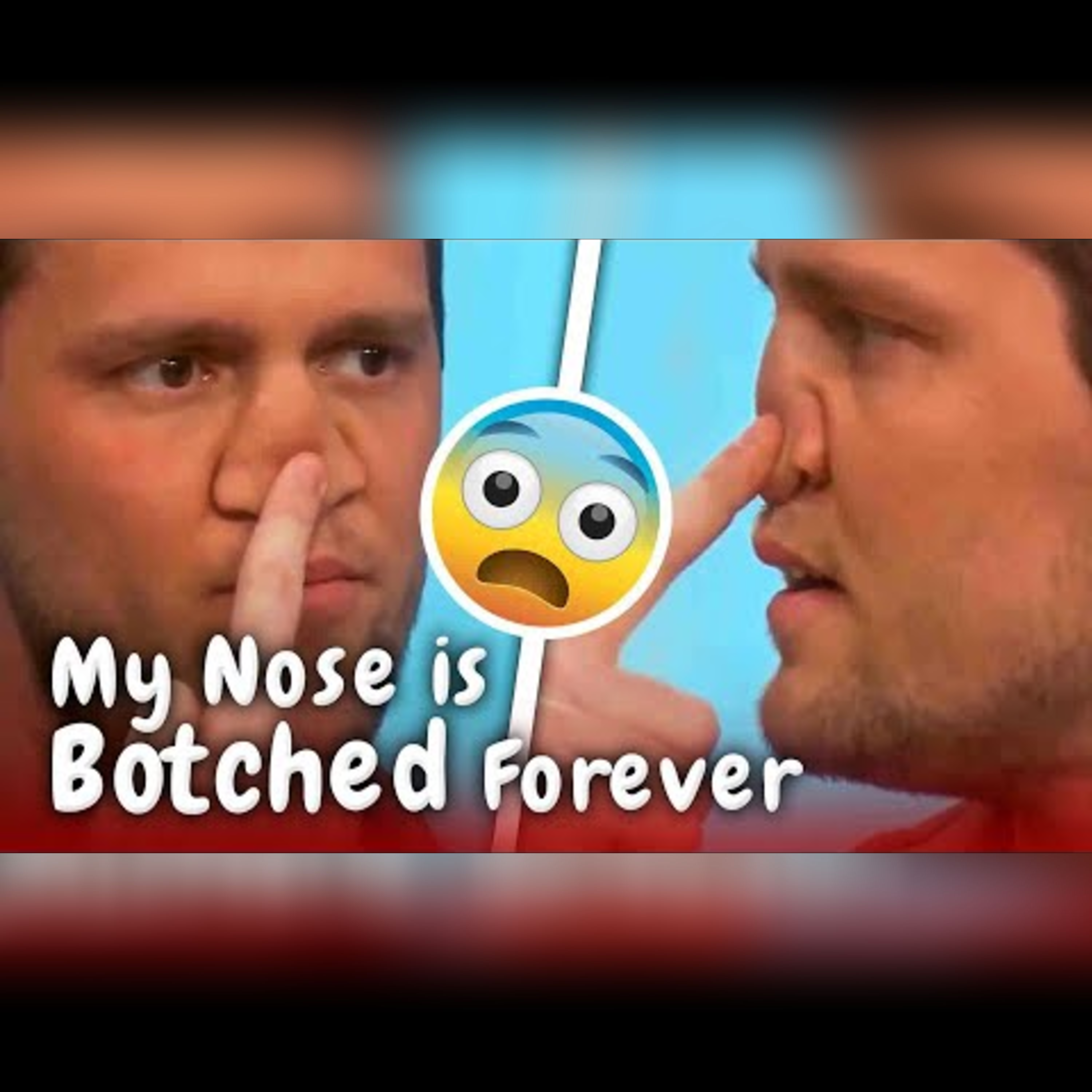 Nose Job Gone Wrong: Can a Botched Surgery Be Fixed? episode artwork