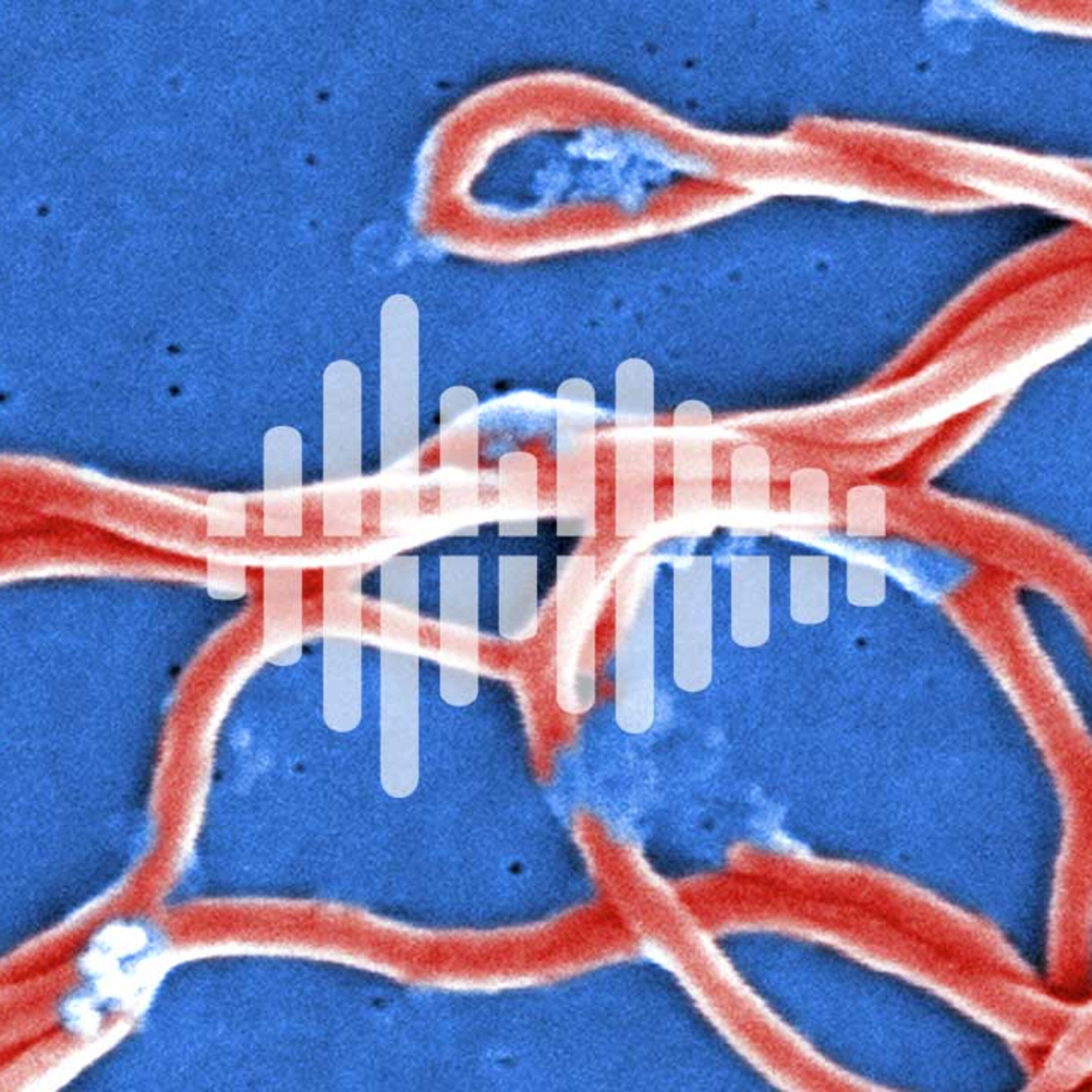 Wildfires could threaten ozone layer, and vaccinating against tick bites