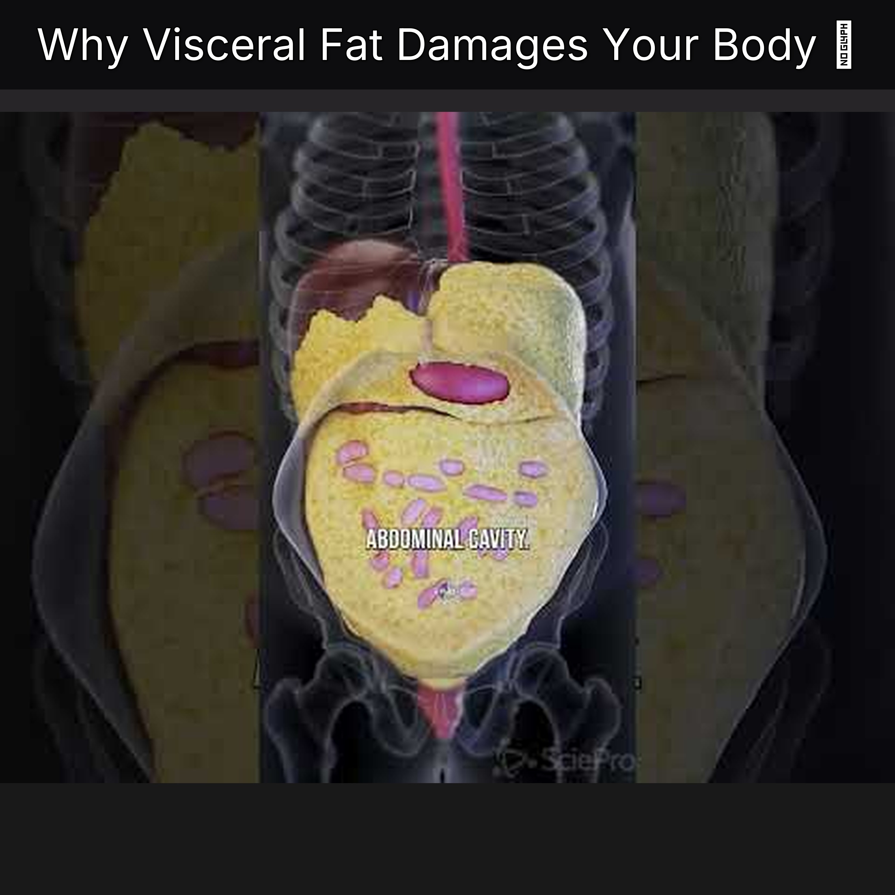 Why Visceral Fat Damages Your Body 👉