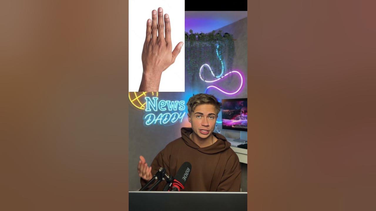 Simple Trick To Tell If You’ll Go Bald! | Dylan Page