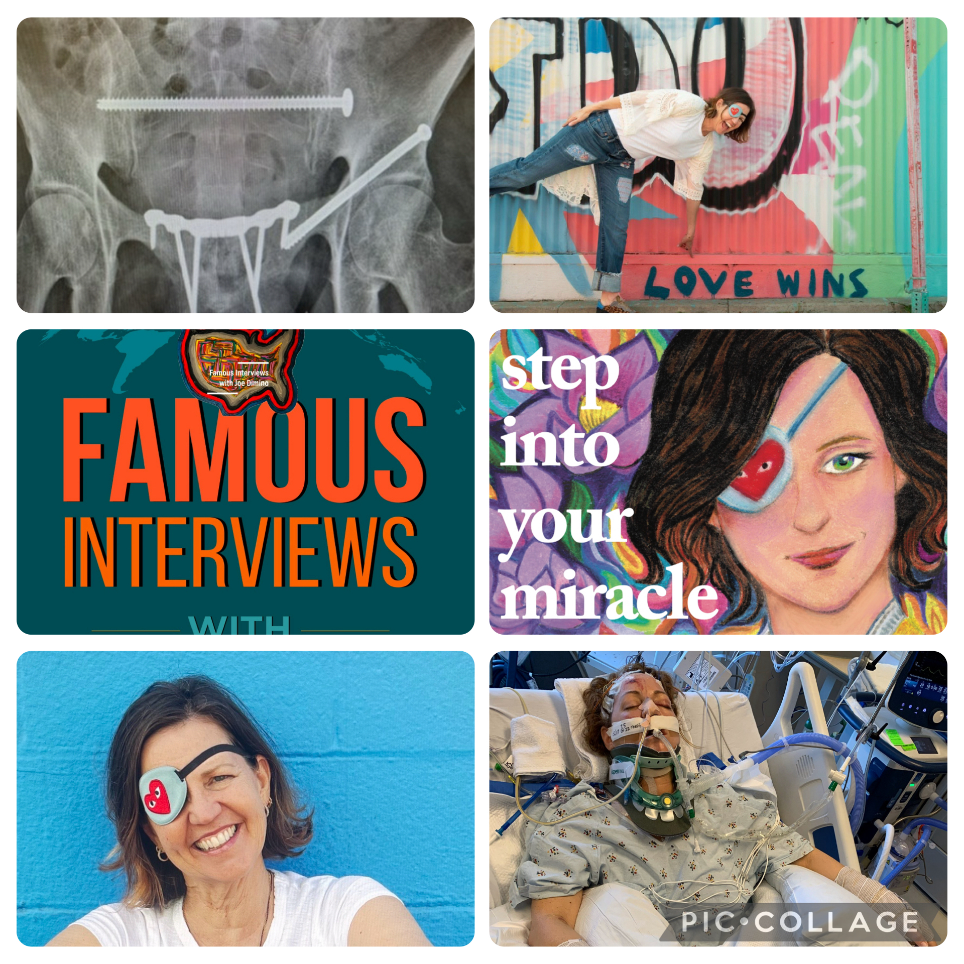 Famous Interviews with Joe Dimino