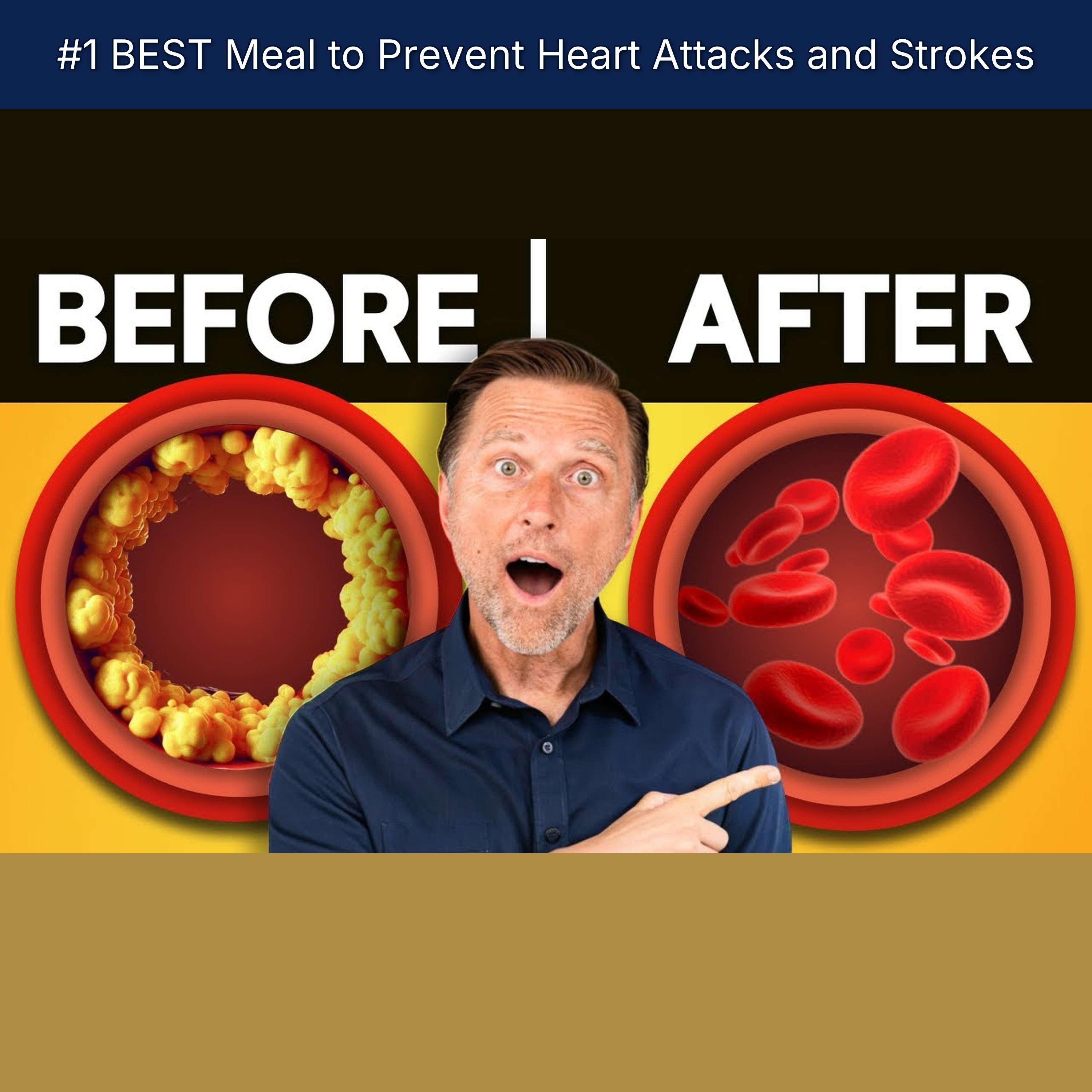 #1 BEST Meal to Prevent Heart Attacks and Strokes episode artwork