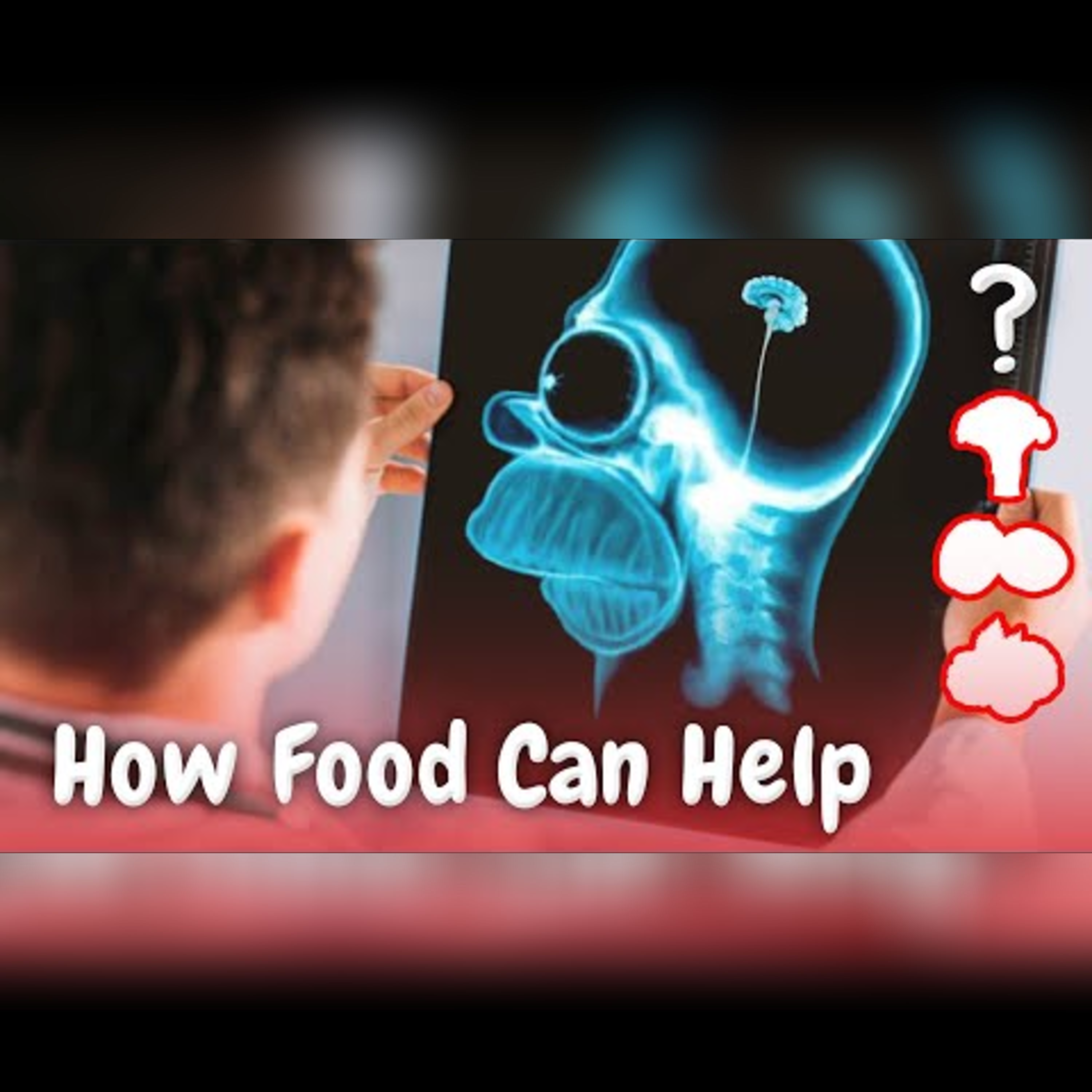 Top 5 Superfoods to Boost Brain Health episode artwork