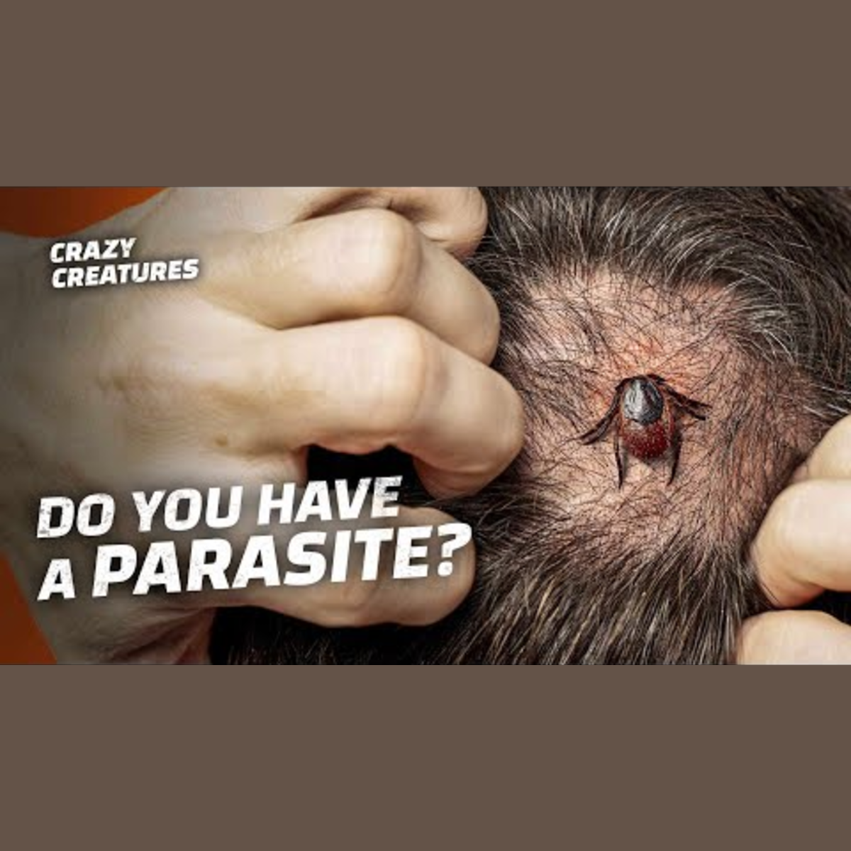 Essential Insights on Parasites and Their Impact episode artwork