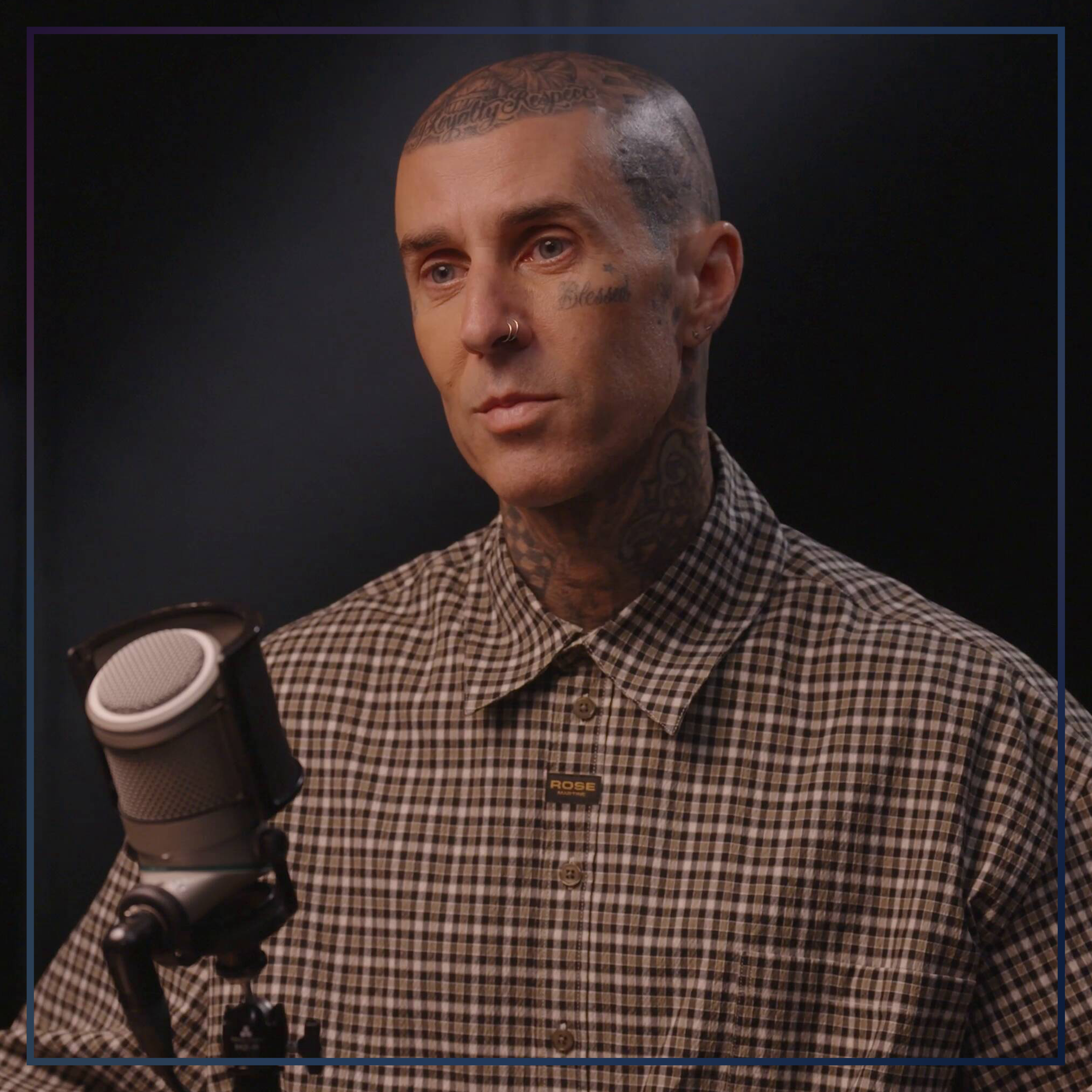 Travis Barker: The ‘Wound That Almost Never Heals’