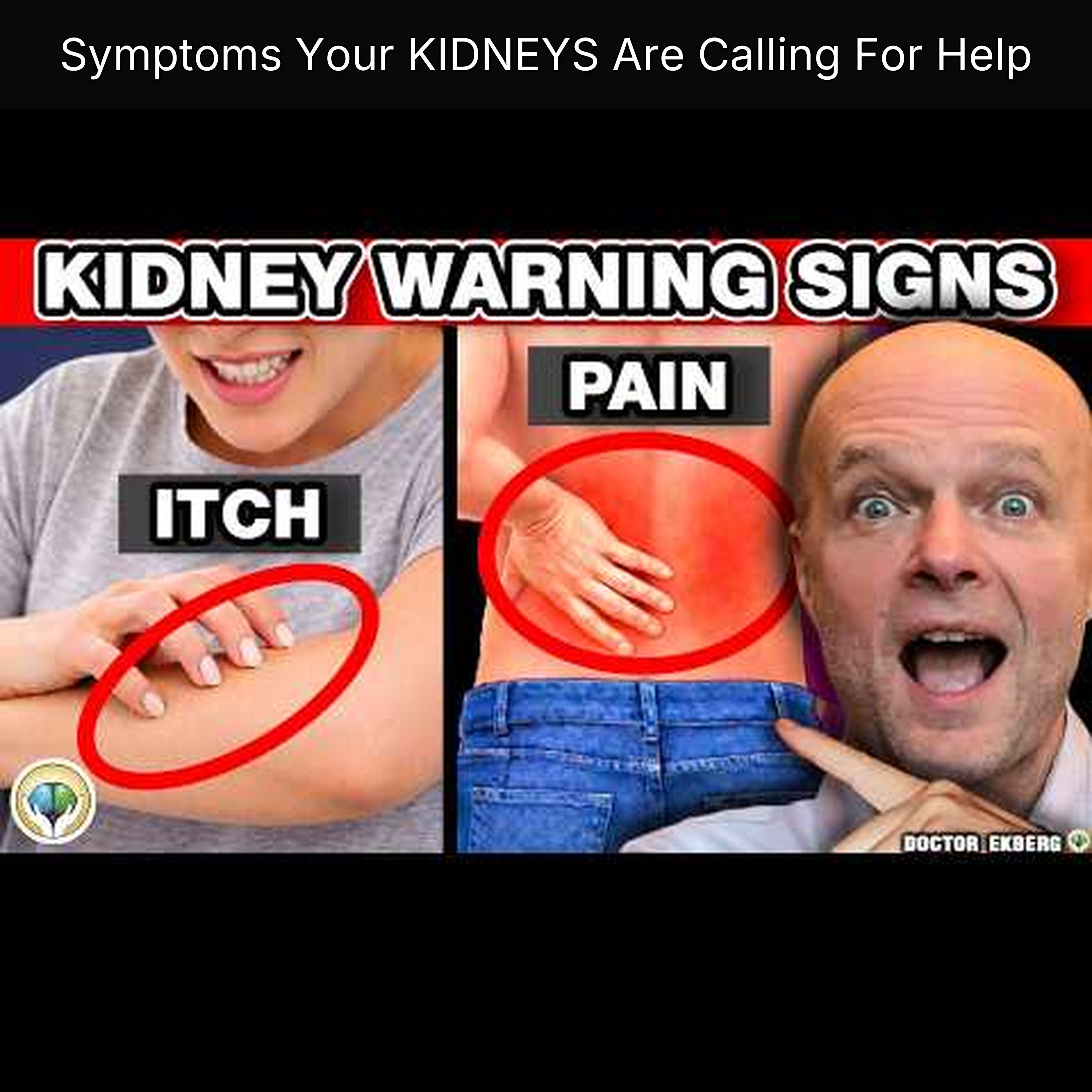 Symptoms Your KIDNEYS Are Calling For Help