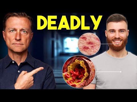 The MOST Dangerous Diseases in the World (& They Don’t Give You Symptoms)