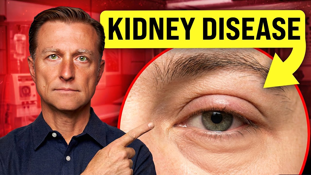 18 Visible Signs of Kidney Disease You Shouldn’t Ignore