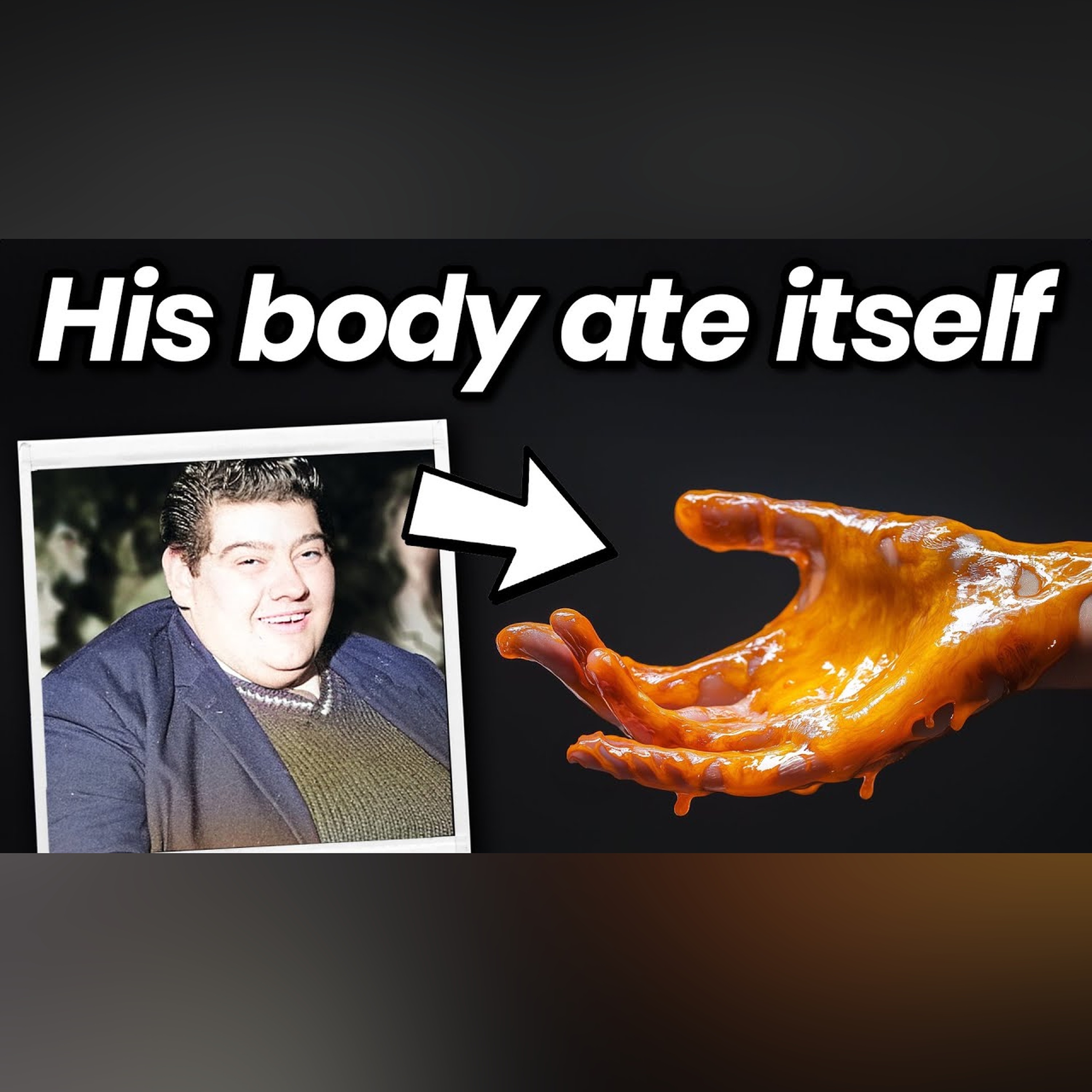 The Man Who Let His Body Eat Itself episode artwork