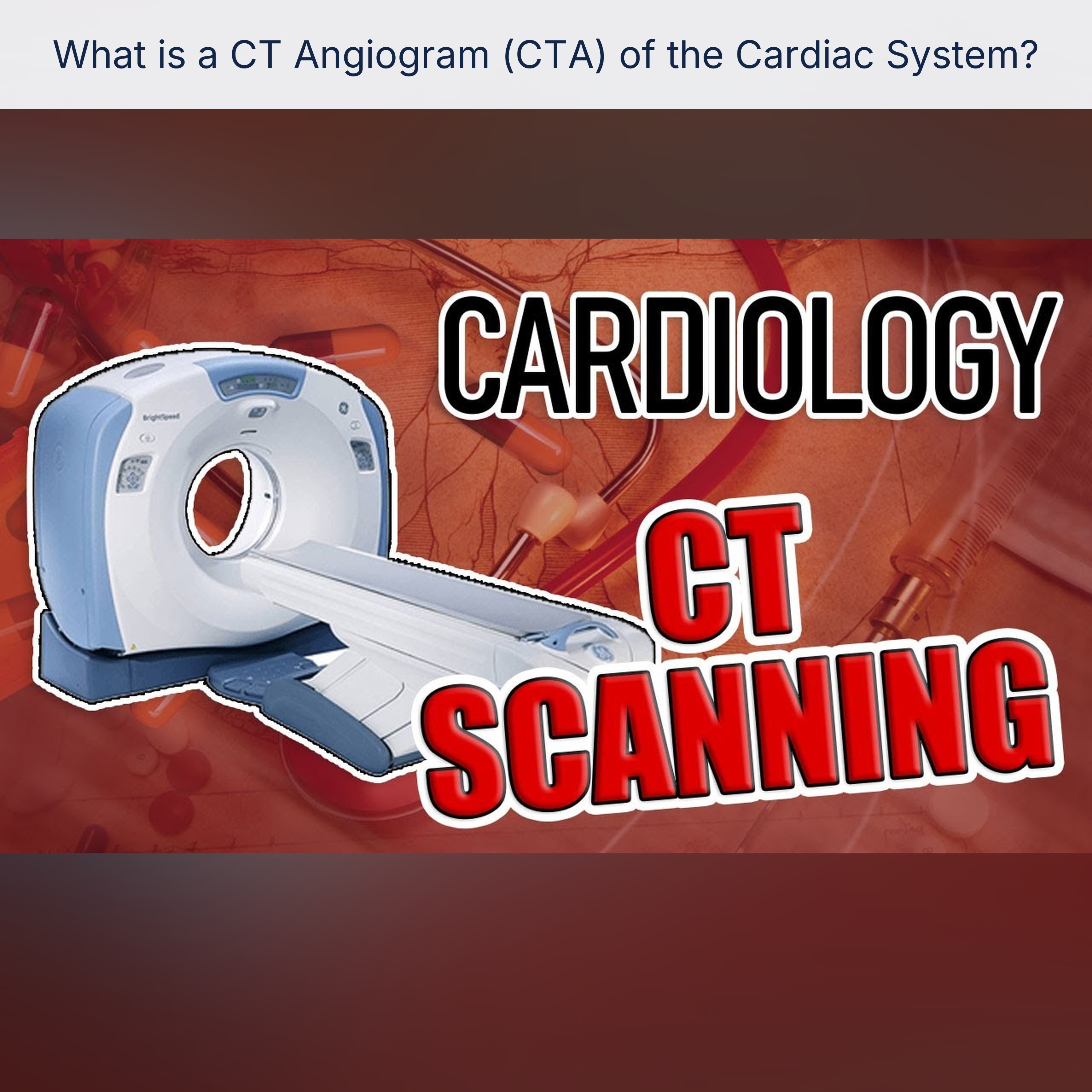 What is a CT Angiogram (CTA) of the Cardiac System? episode artwork