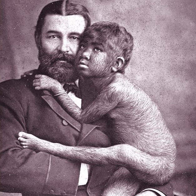 11. A Brief "Dark" History Of Freak Shows | A Day In History episode artwork