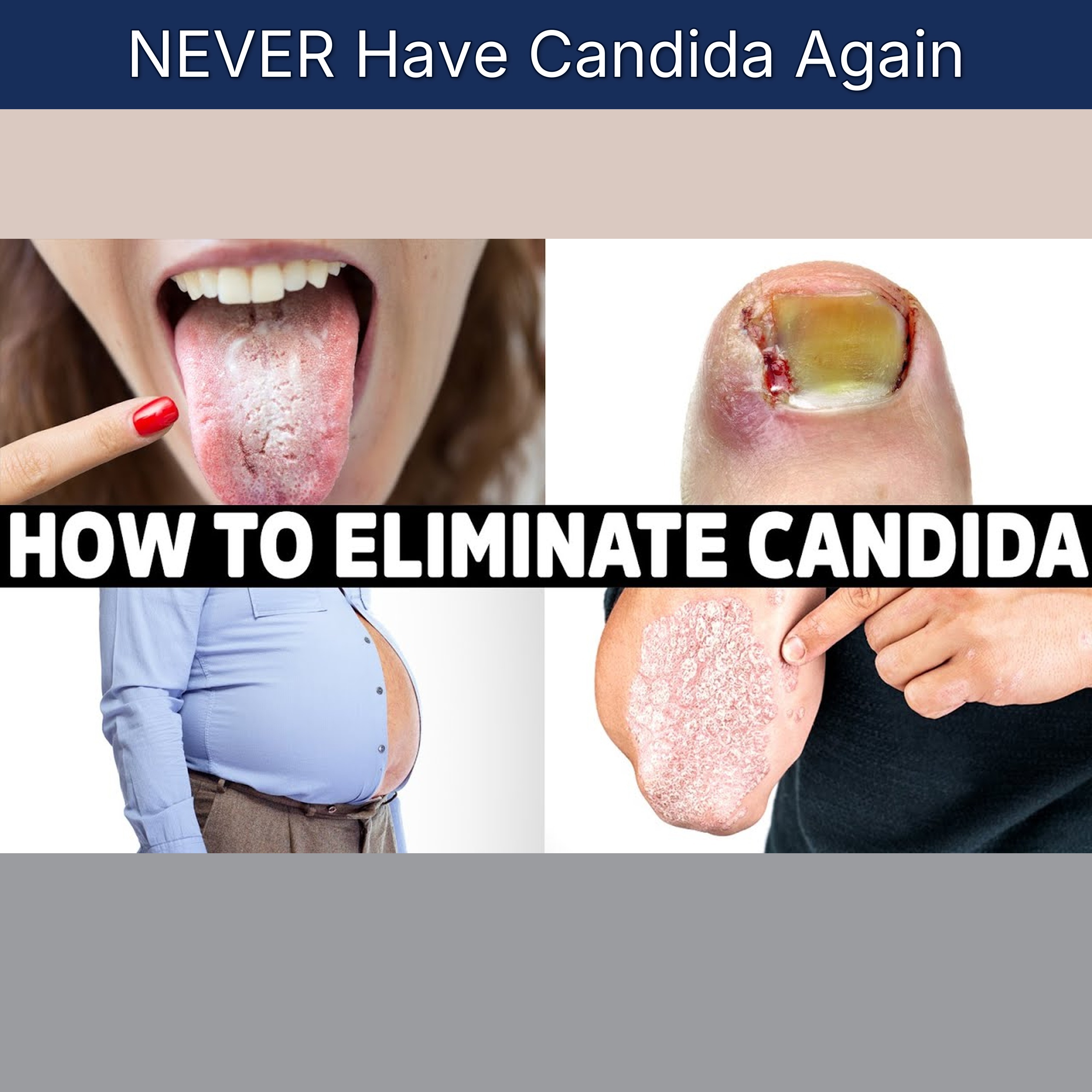 NEVER Have Candida Again episode artwork