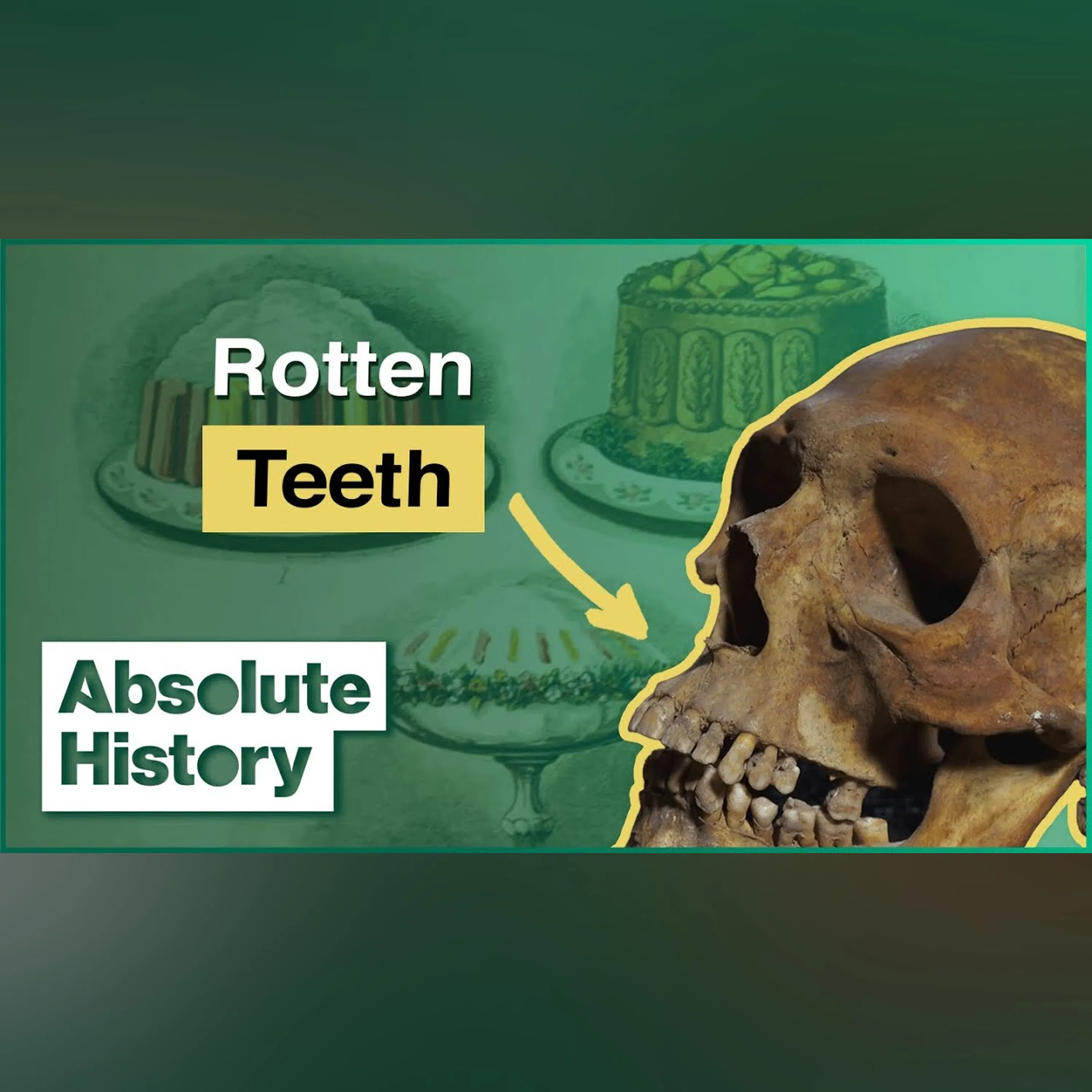 The Sweet Treat That Had The Tudors Hooked | Hidden Killers | Absolute History episode artwork