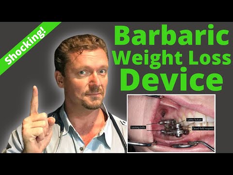 Barbaric New WEIGHT LOSS Device! (Weight Loss Research Insanity?) 2026