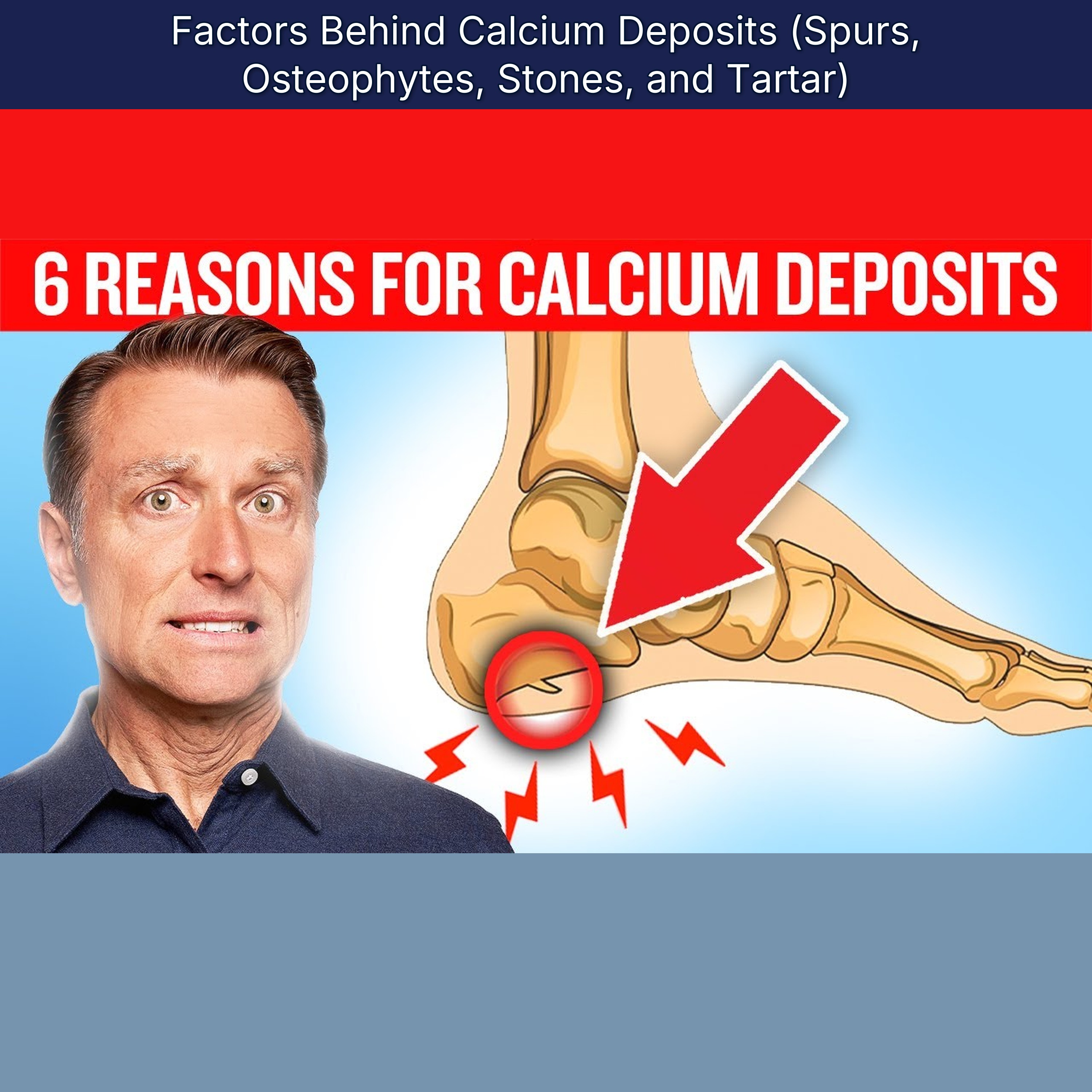 Factors Behind Calcium Deposits (Spurs, Osteophytes, Stones, and Tartar)