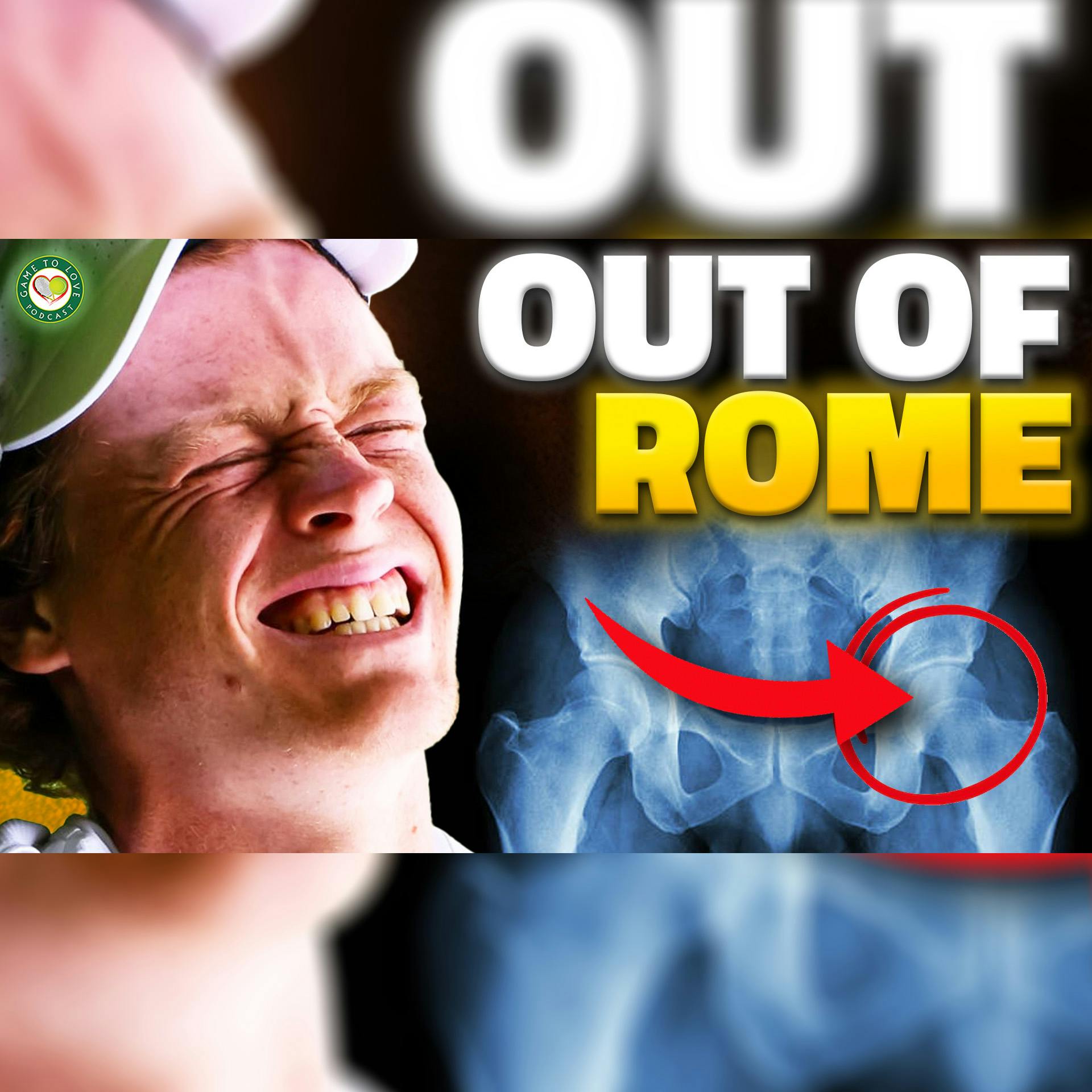 Sinner Injury FORCES him to WITHDRAW! | Rome Masters 2024 | GTL Tennis News