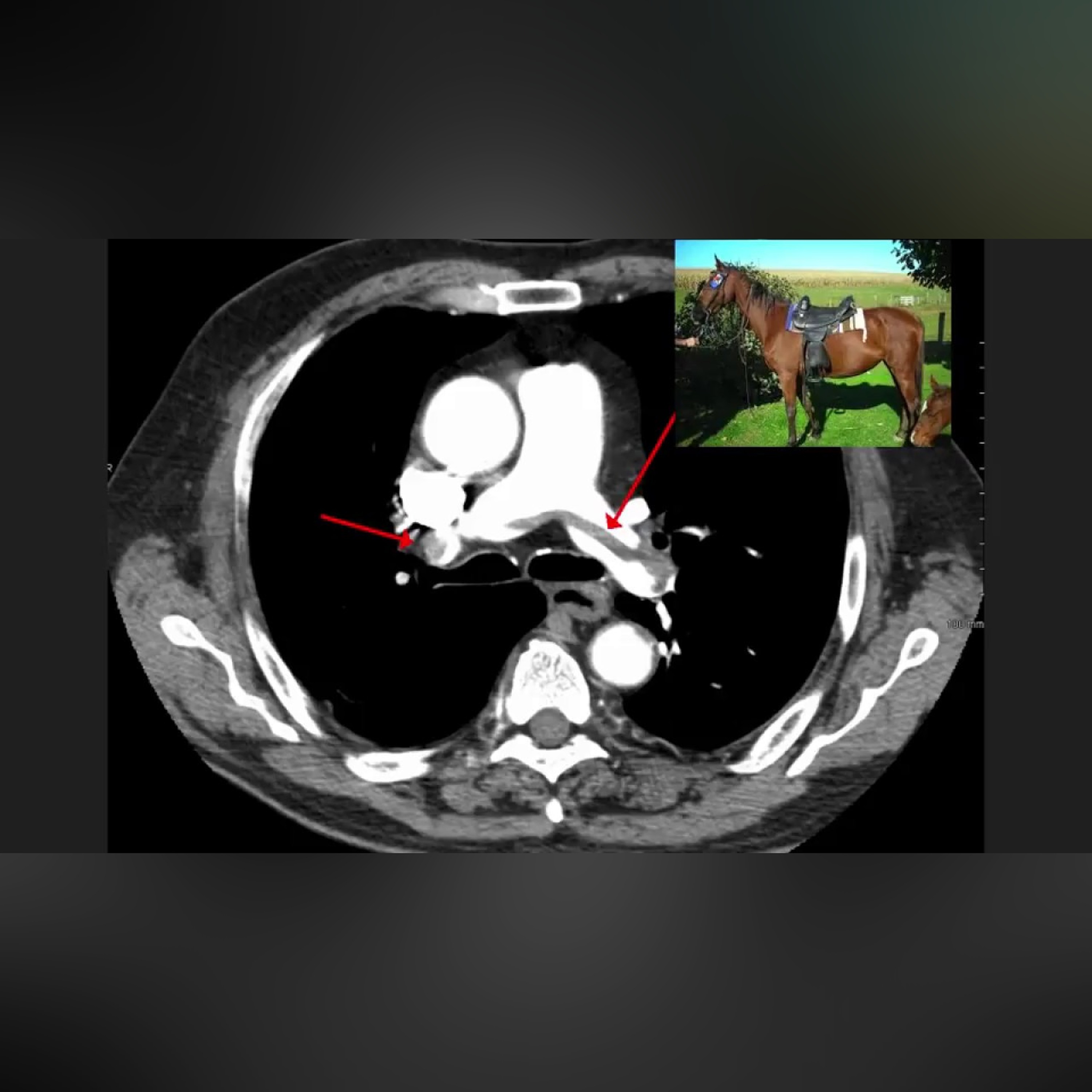 High Yield CT Scans (Part 1) || USMLE episode artwork