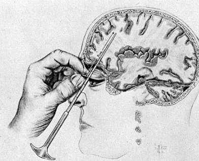 Evolution of Schizophrenia Treatment